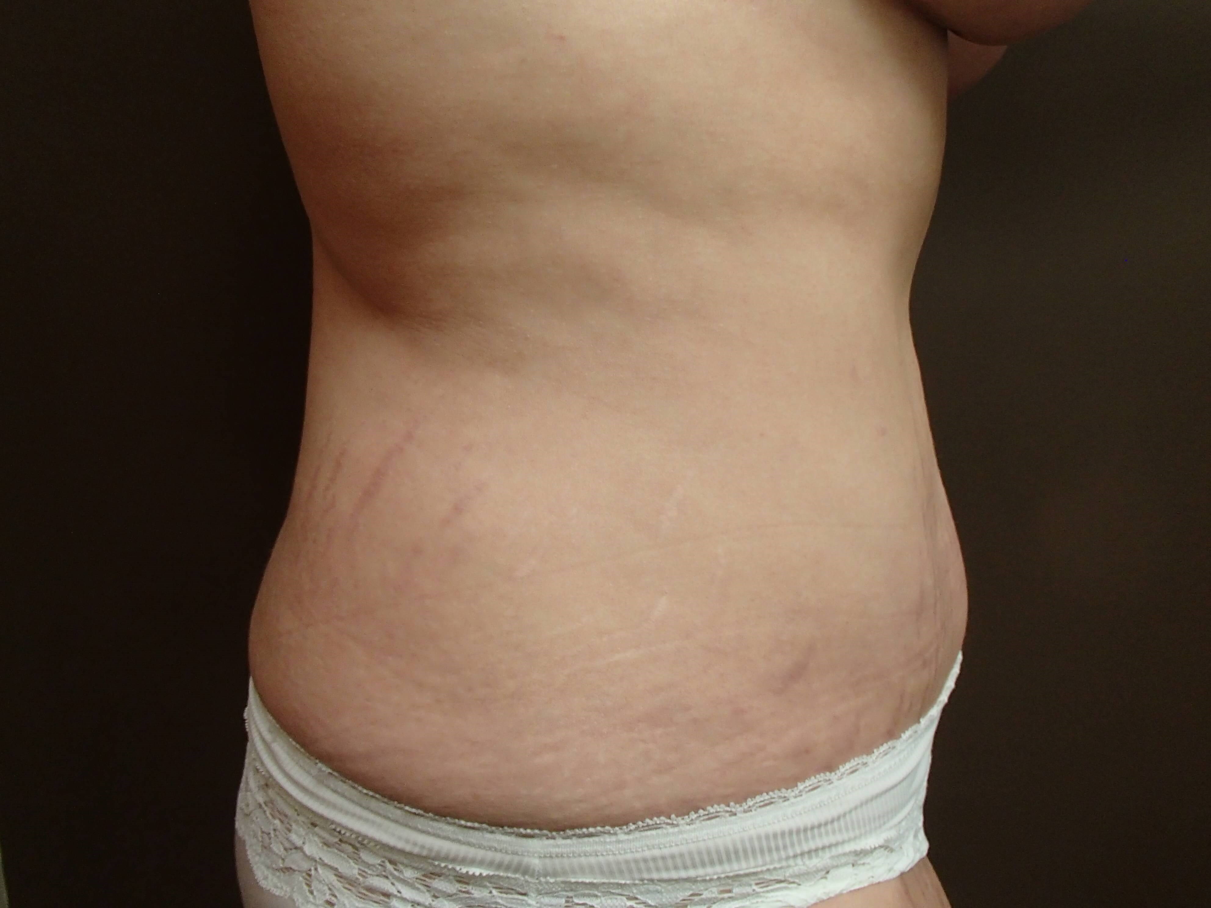 Timeless Tuck After