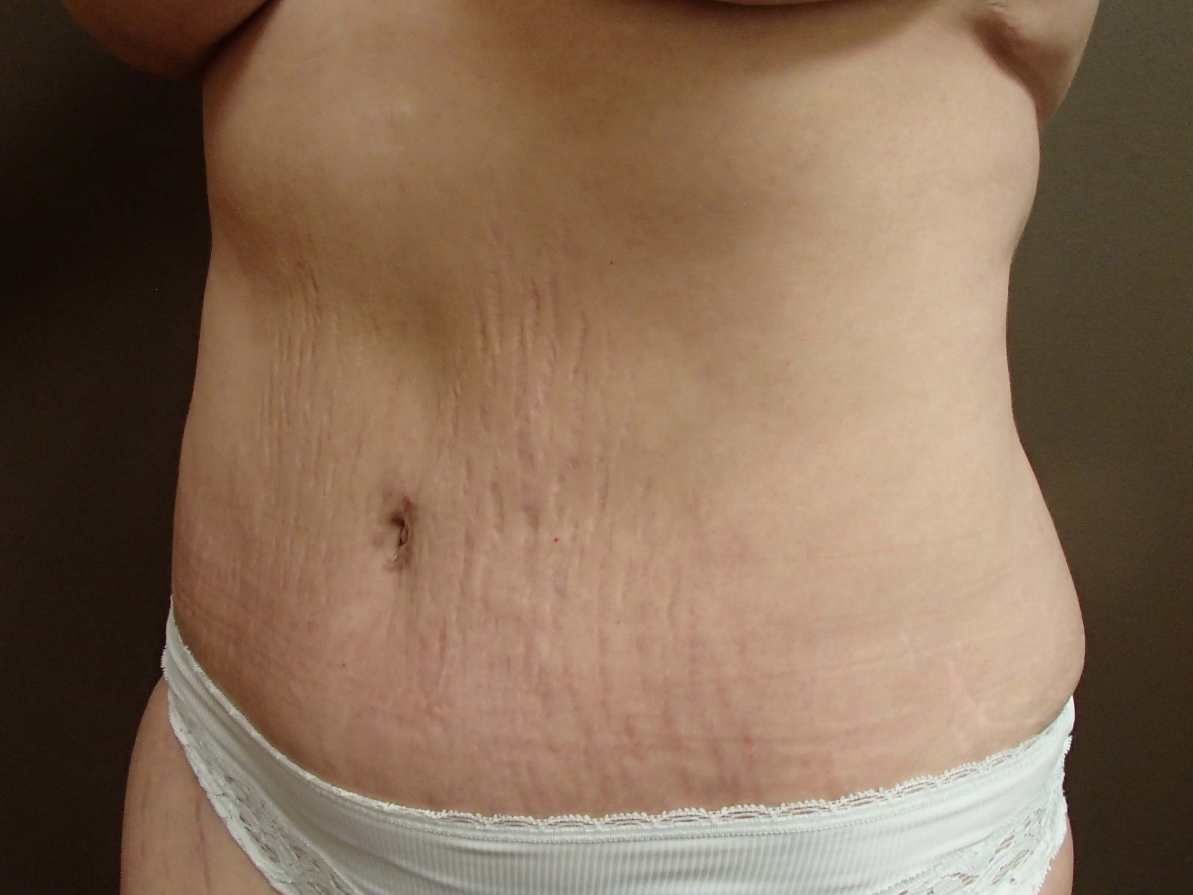 Timeless Tuck After