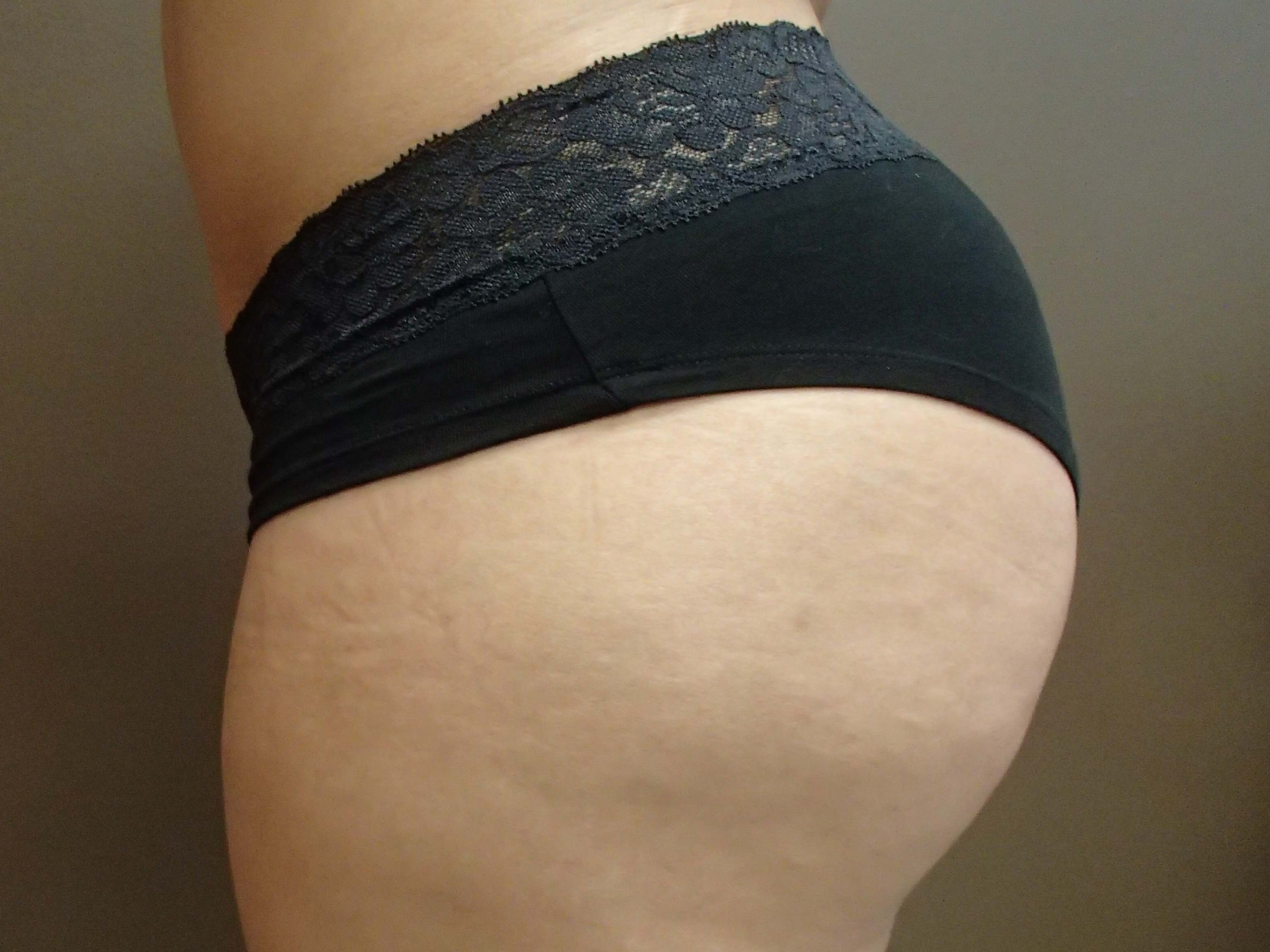 Brazilian Butt Lift (BBL) After
