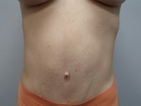 After Image
