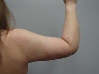 After Image