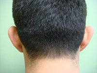 Before Image