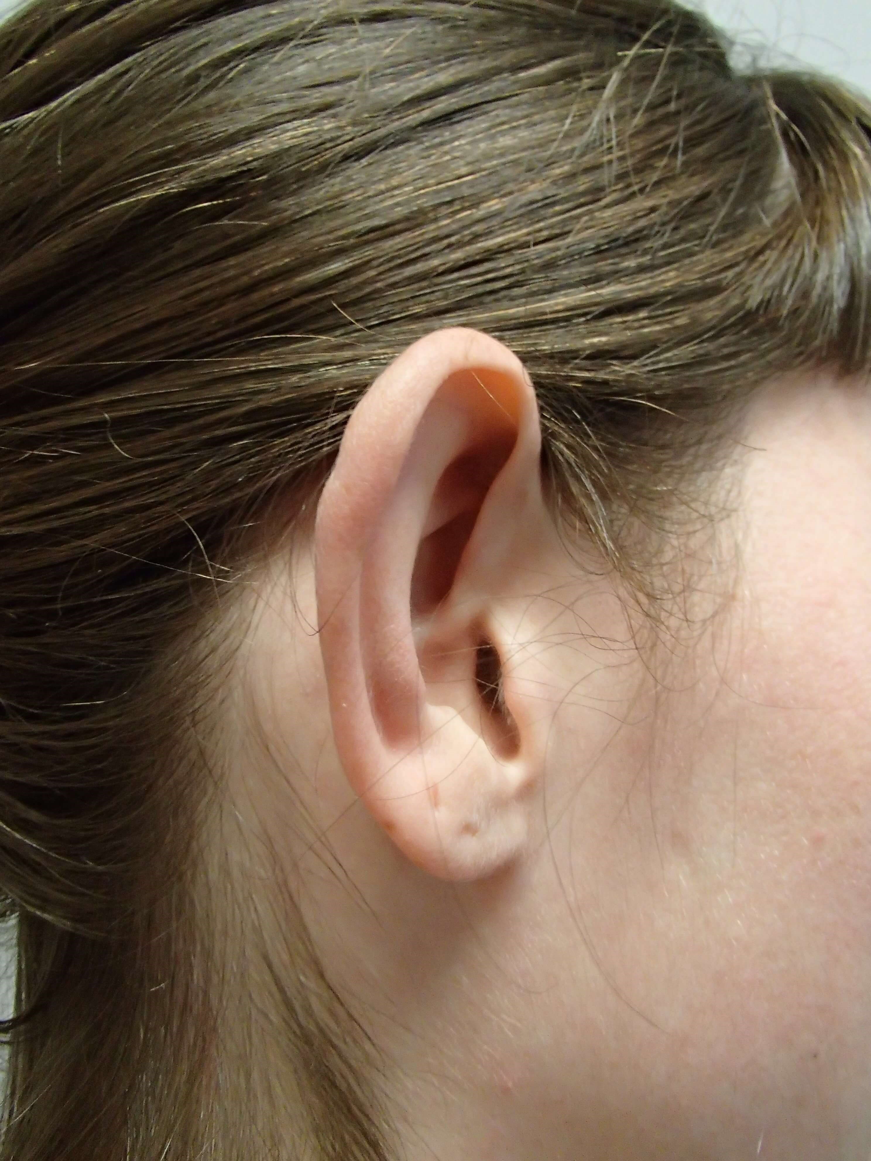 Before Image