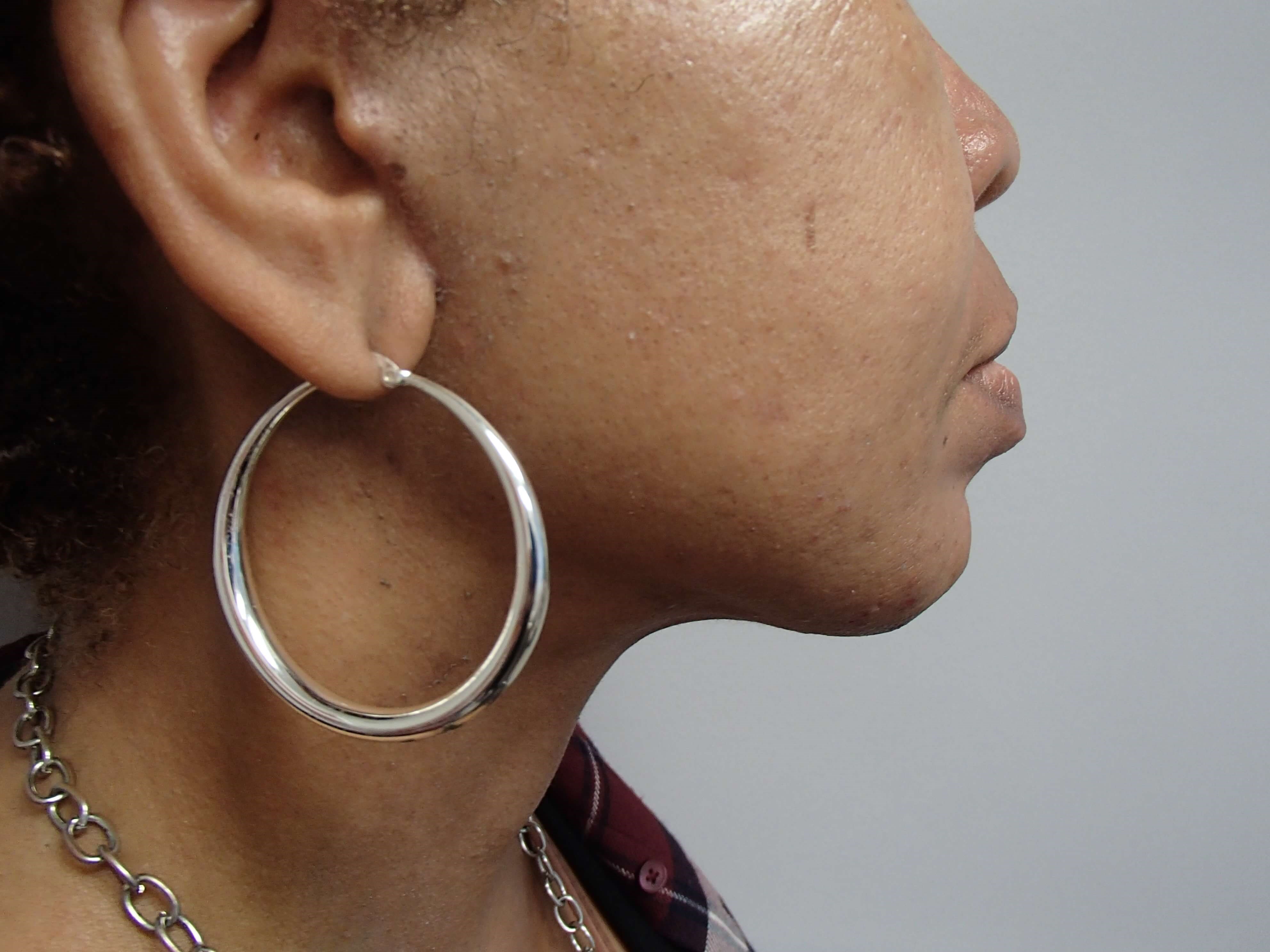 Necklift After