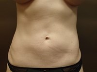After Image