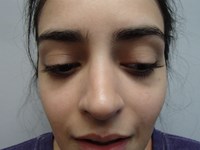 After Image