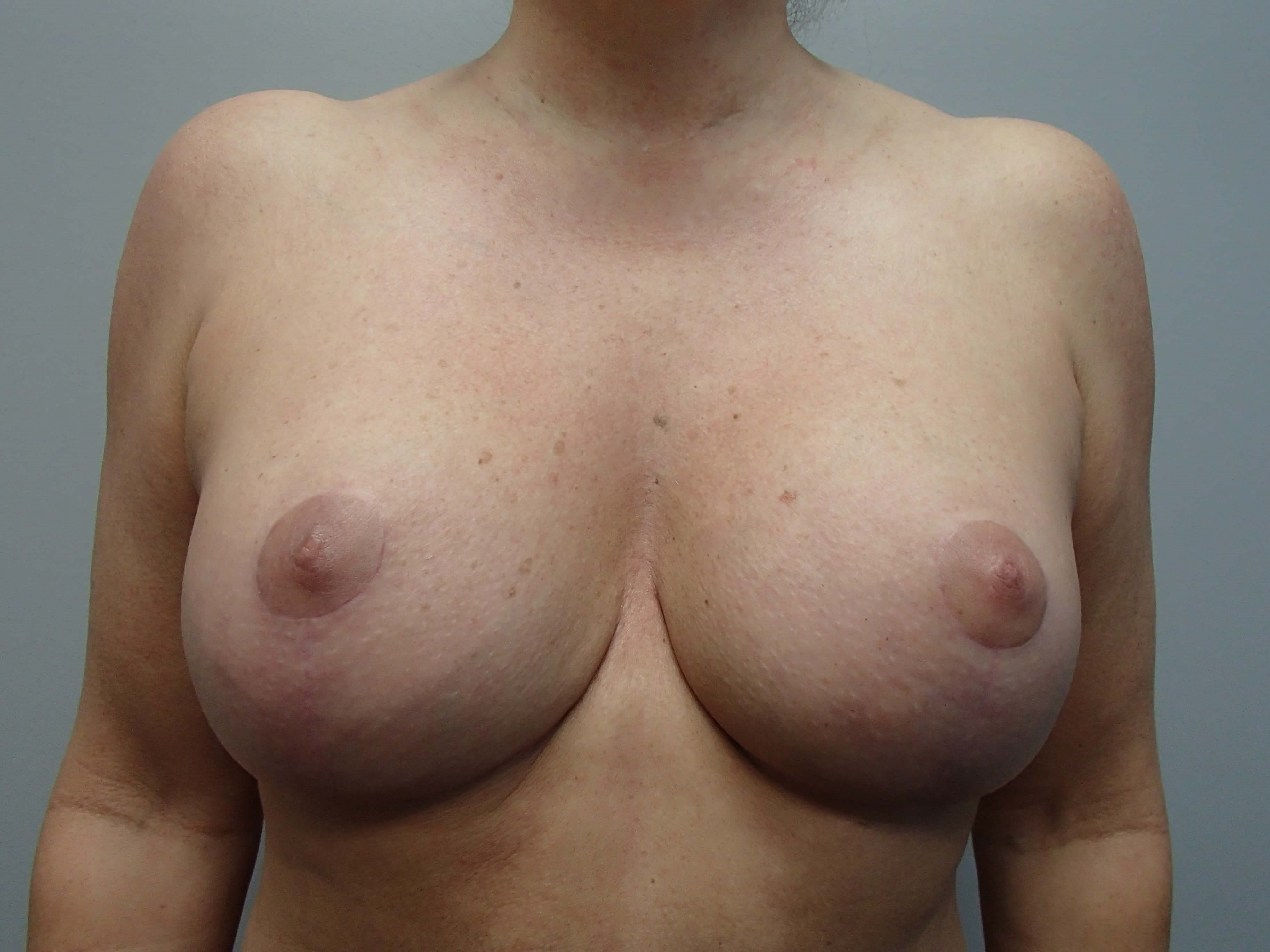 After Image