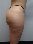 After Image