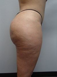 After Image