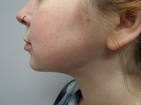 After Image