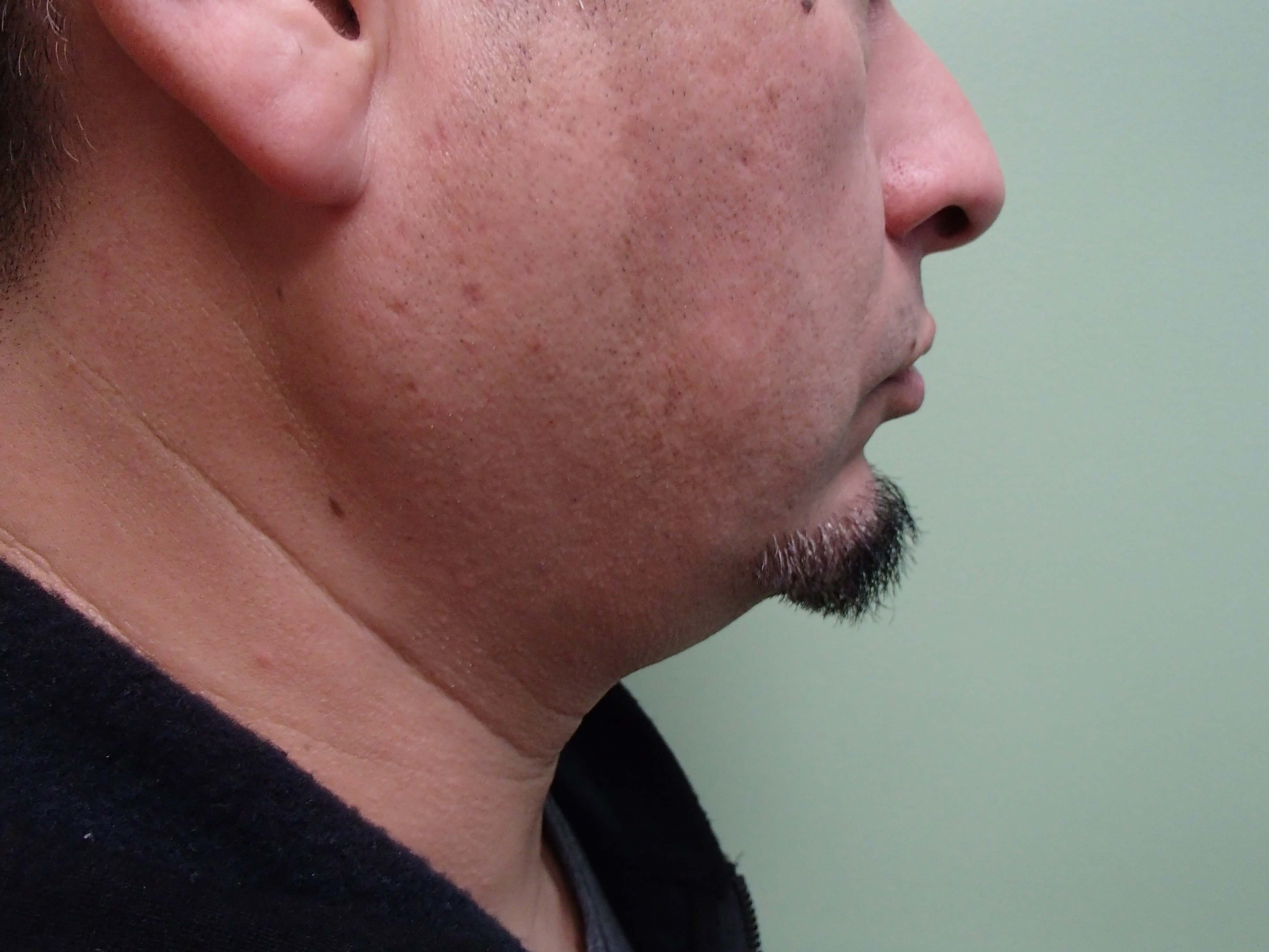 Before Image