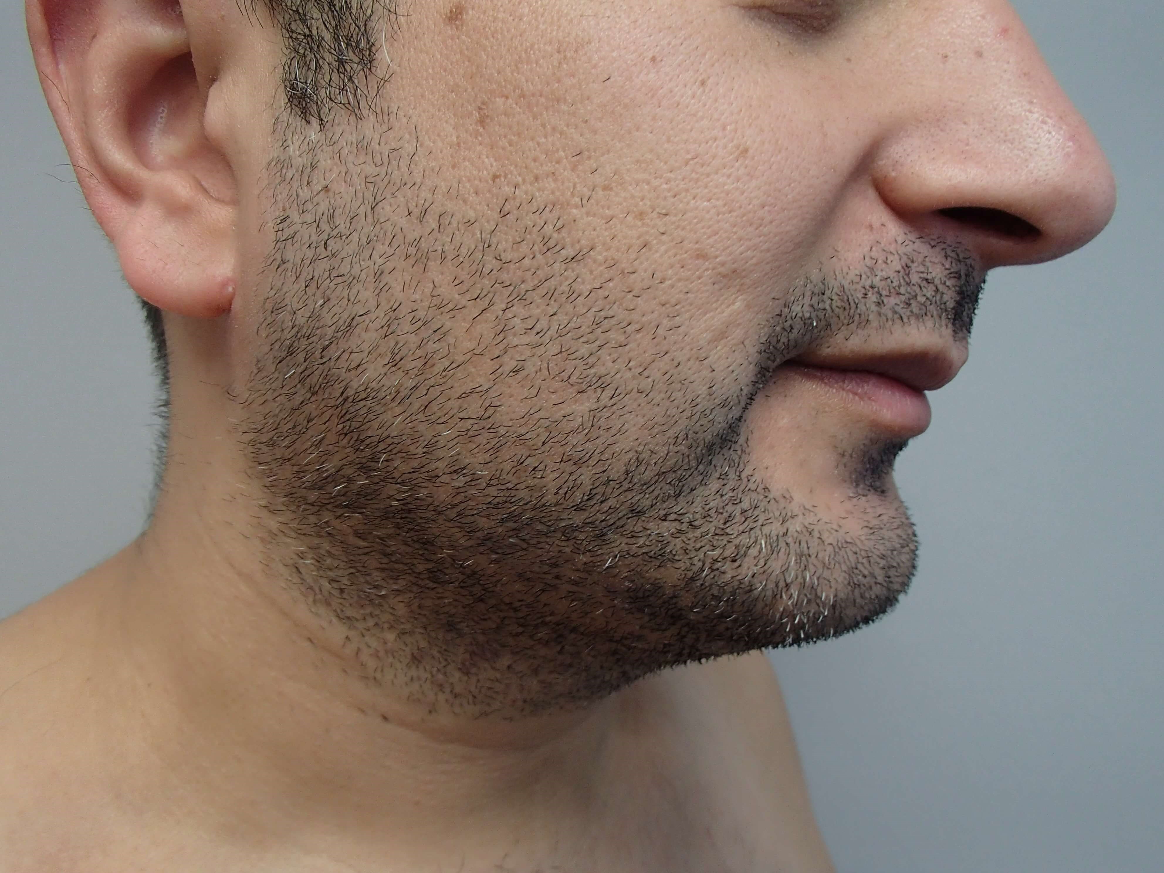 After Image