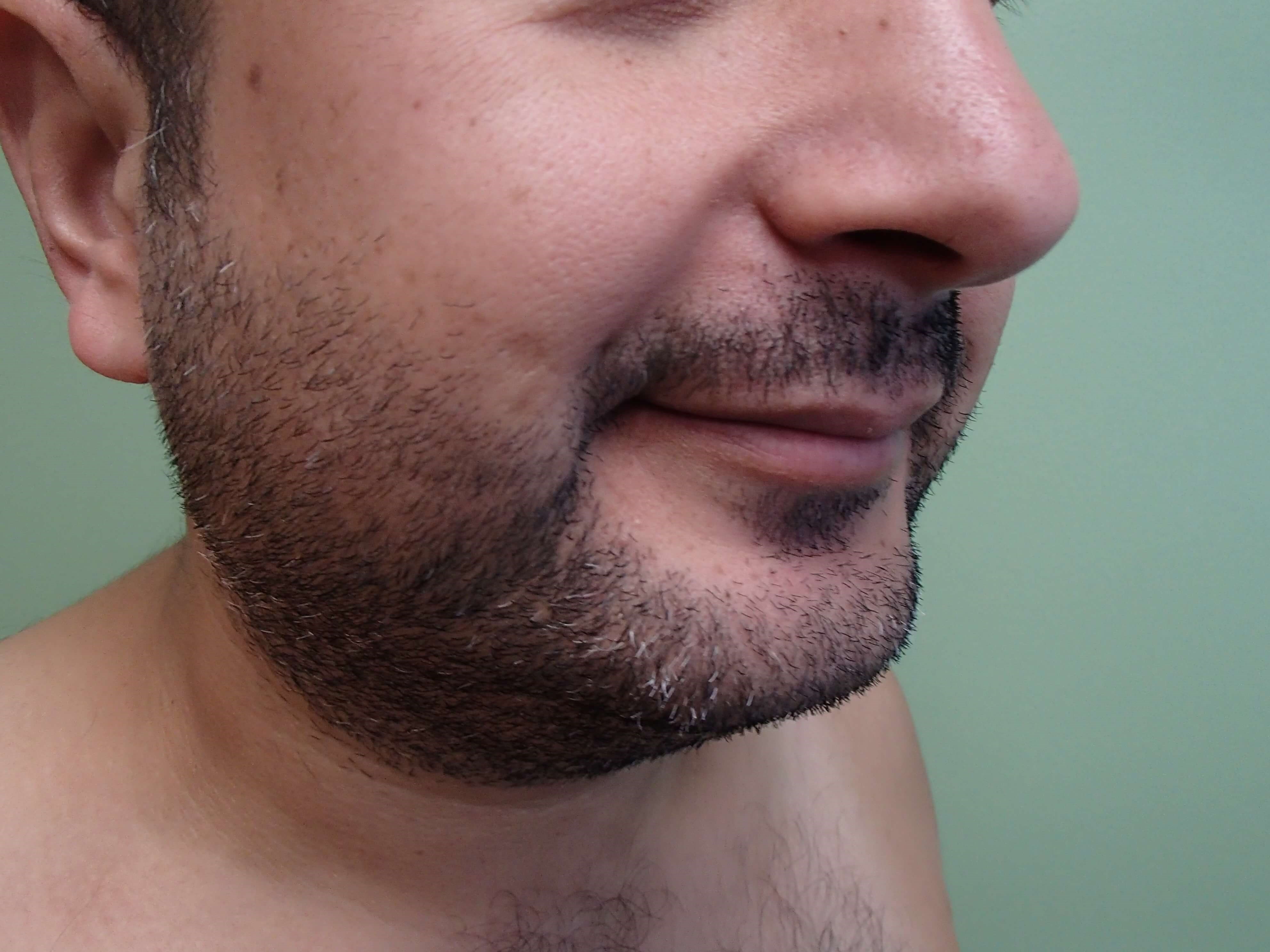 Before Image