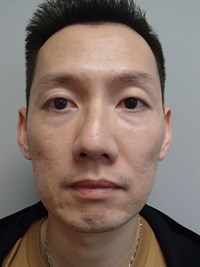 Before Image