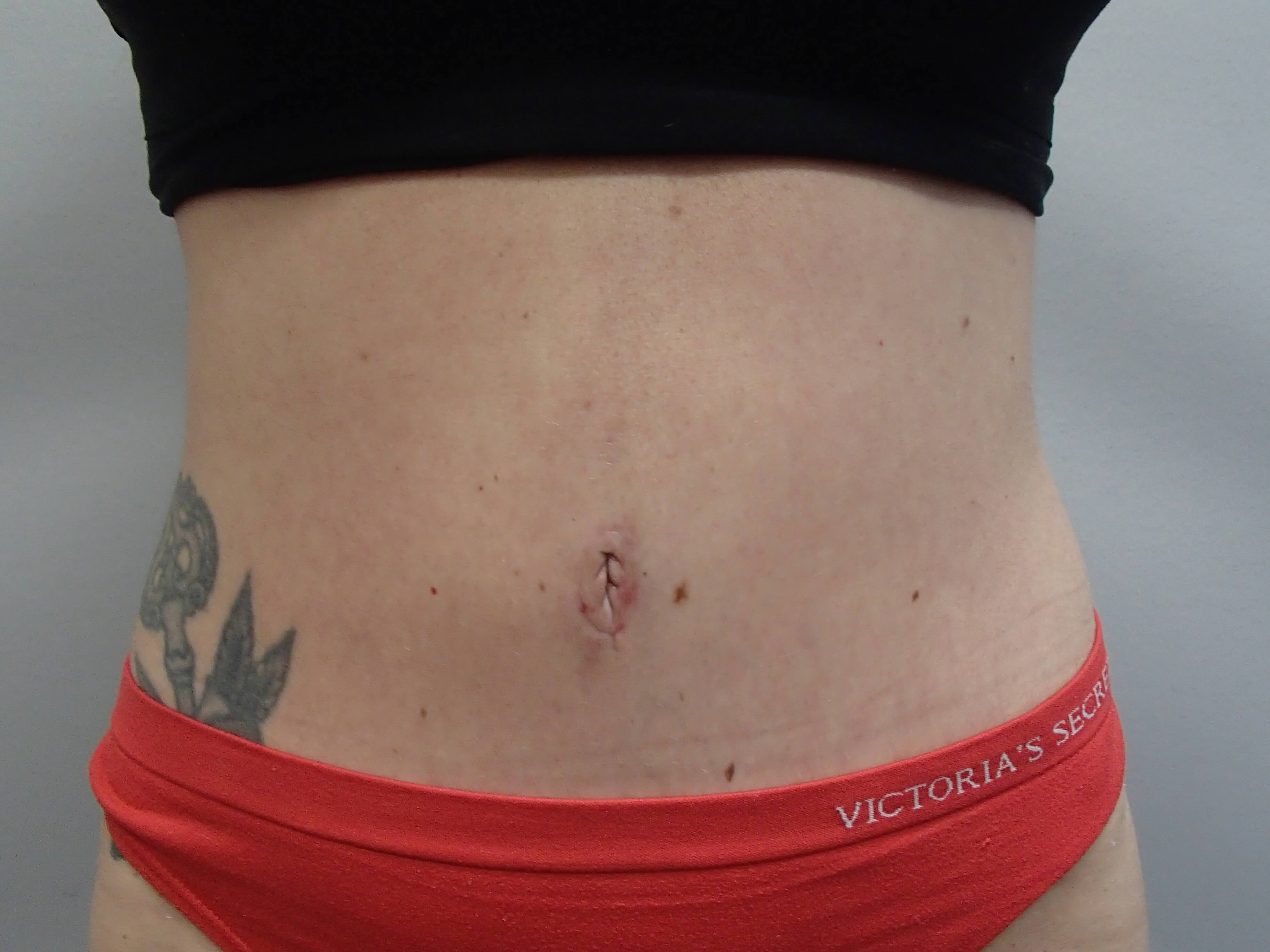 After Image
