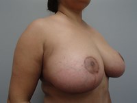 After Image