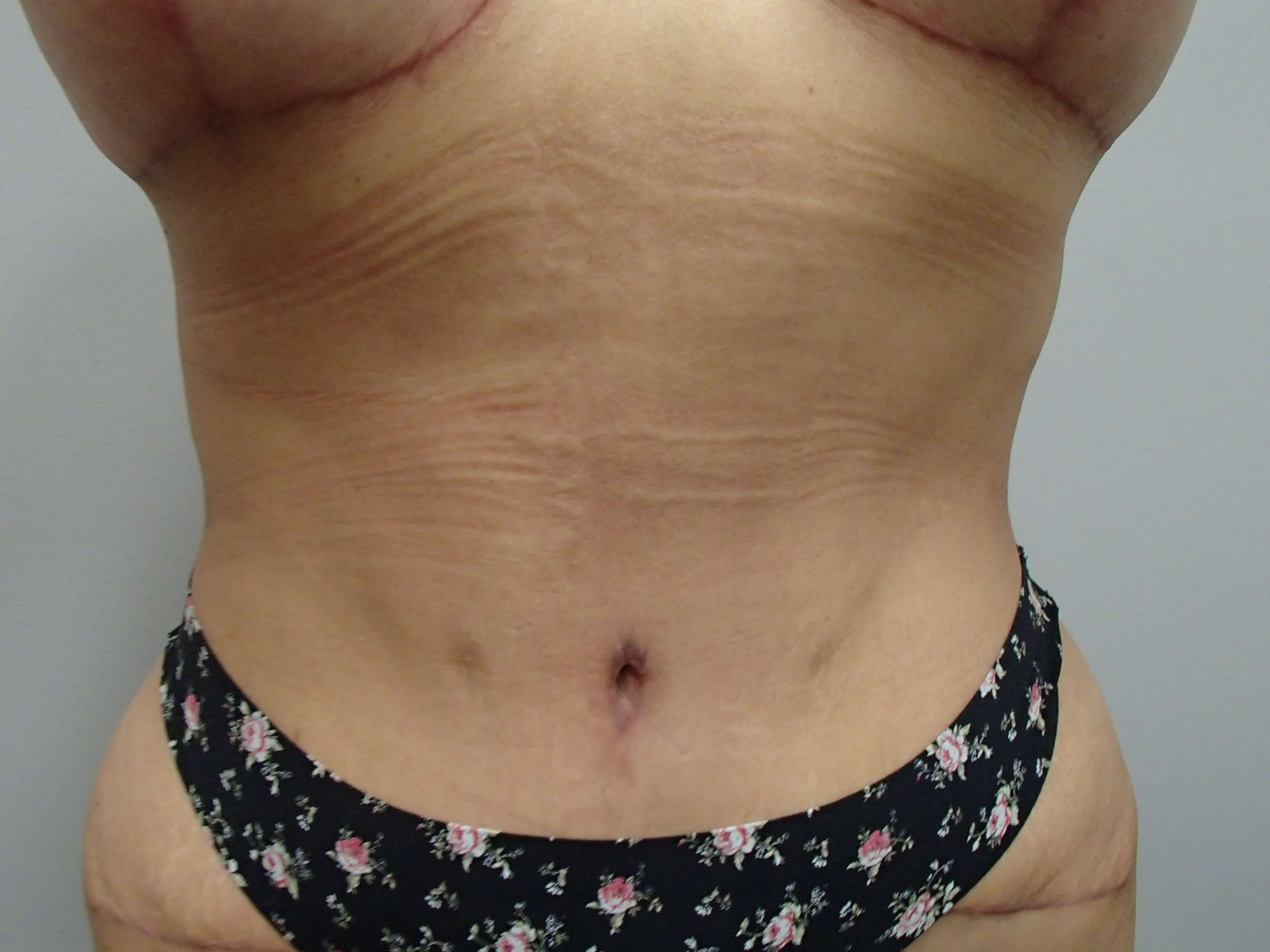 After Image