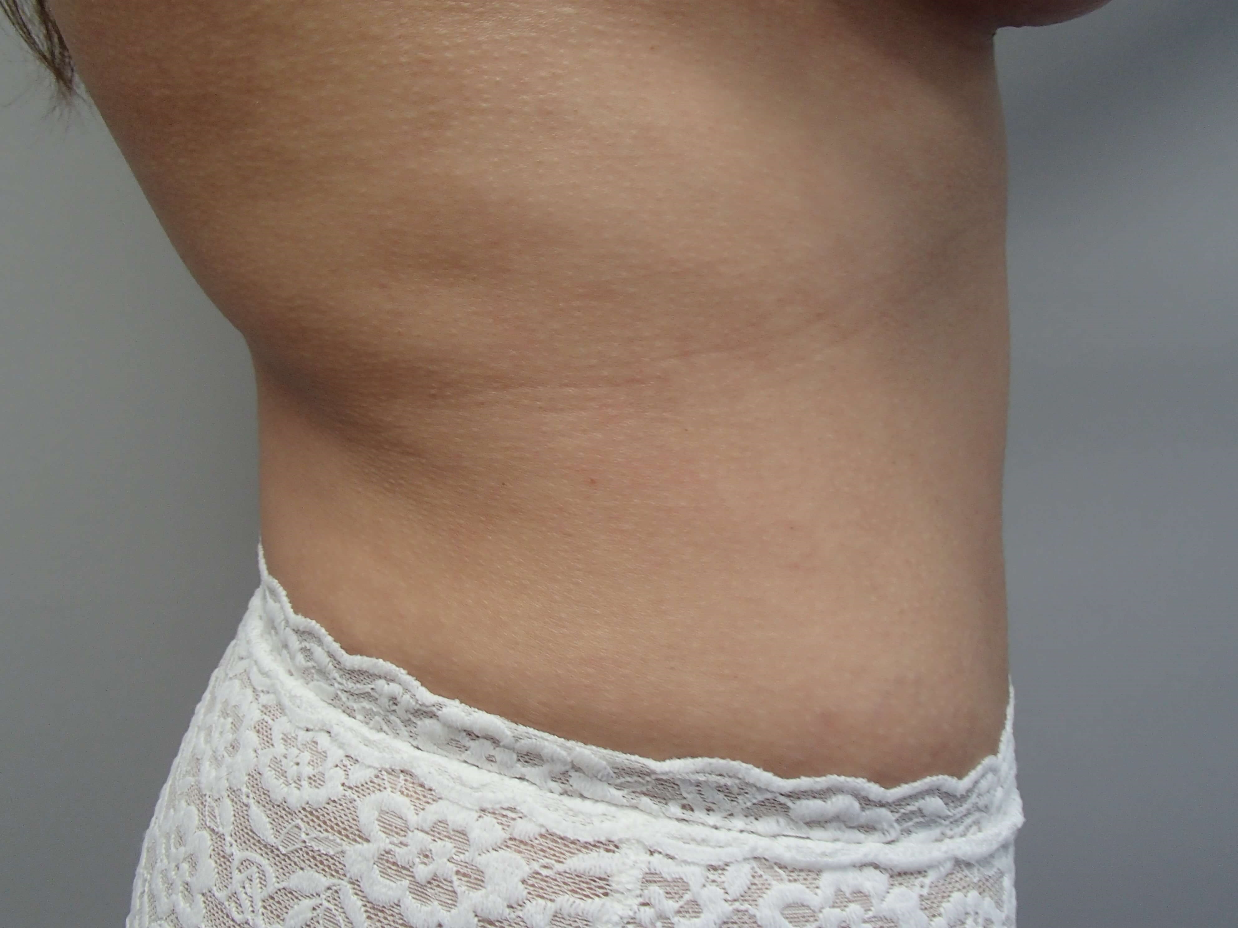Timeless Tuck After