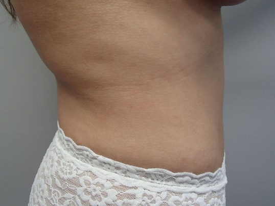Timeless Tuck After