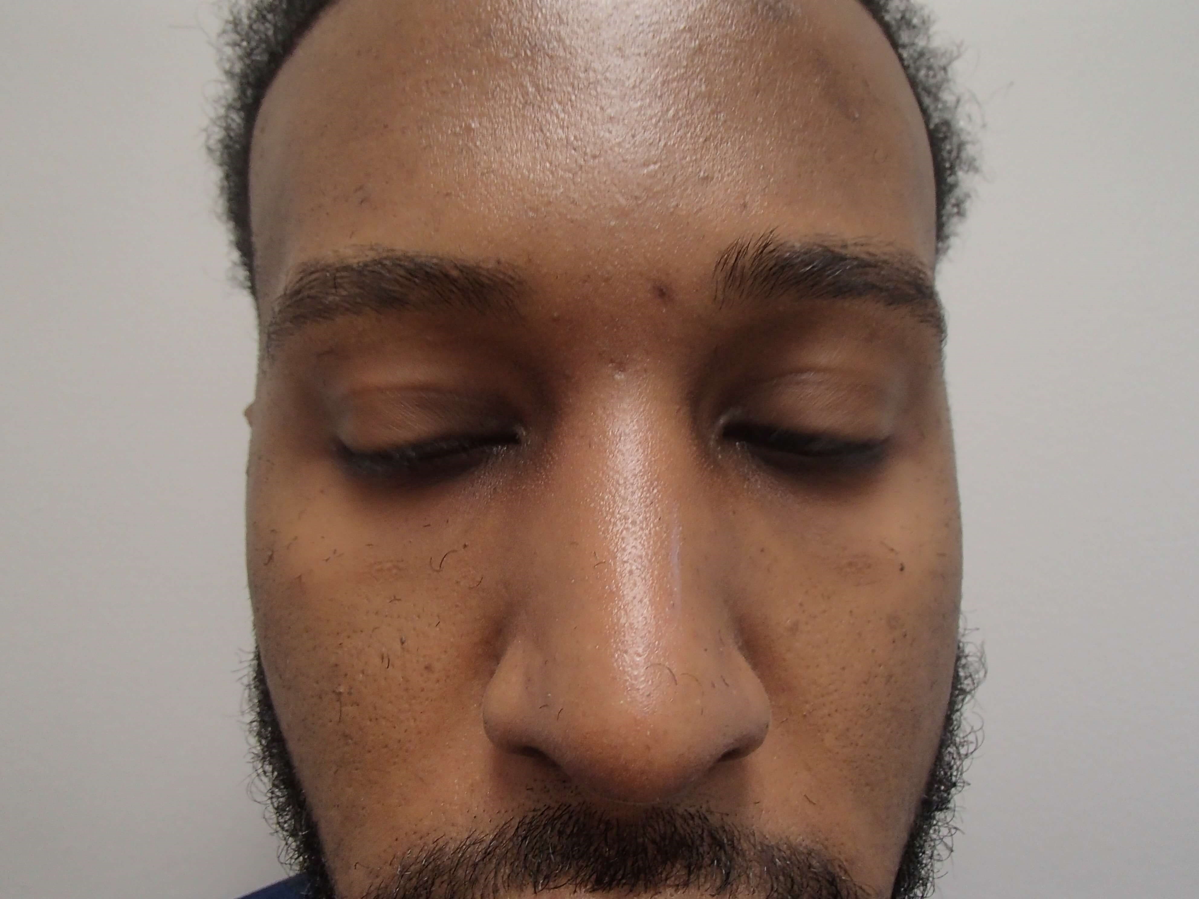 After Image