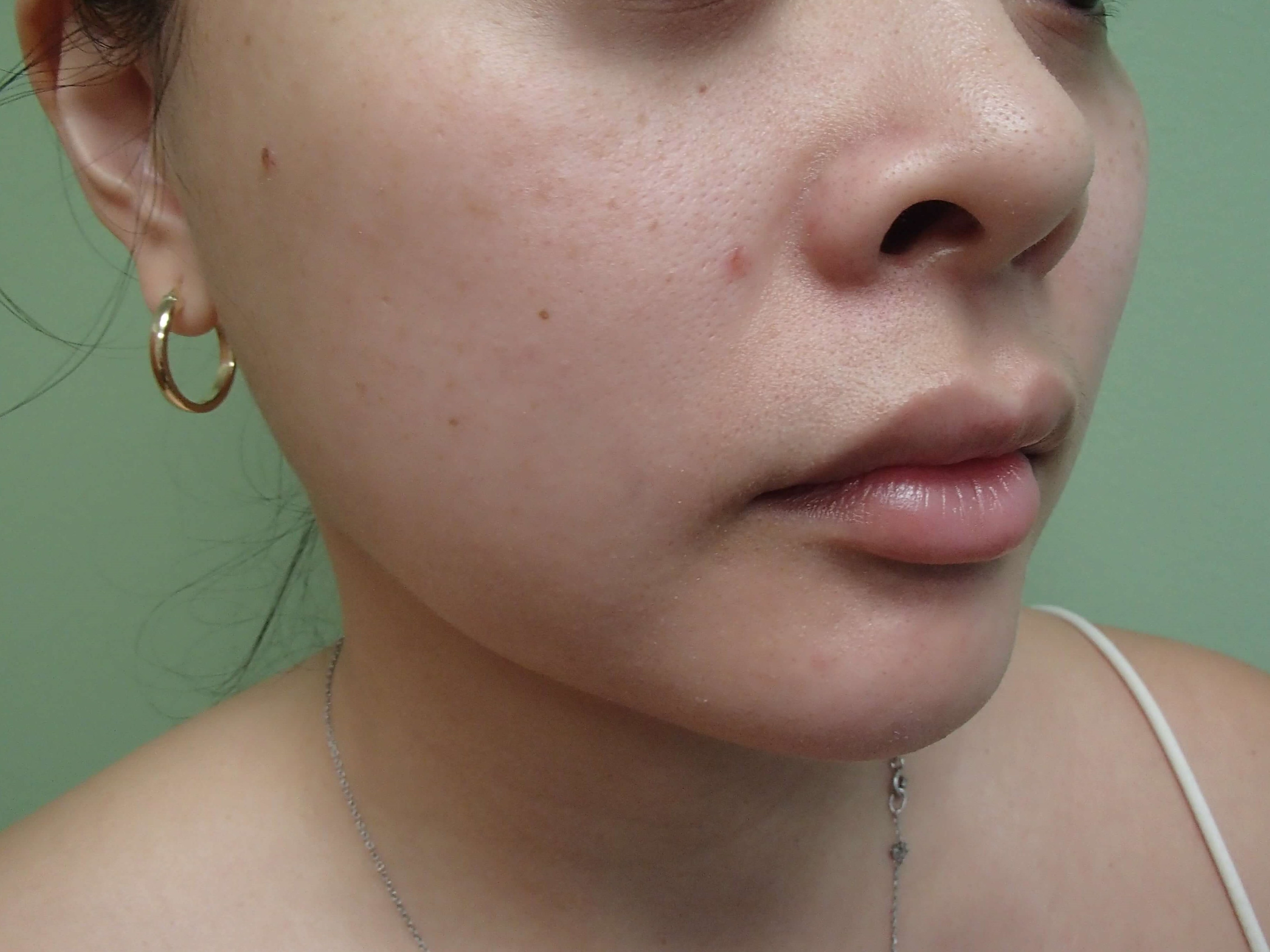 Facial Contouring Before