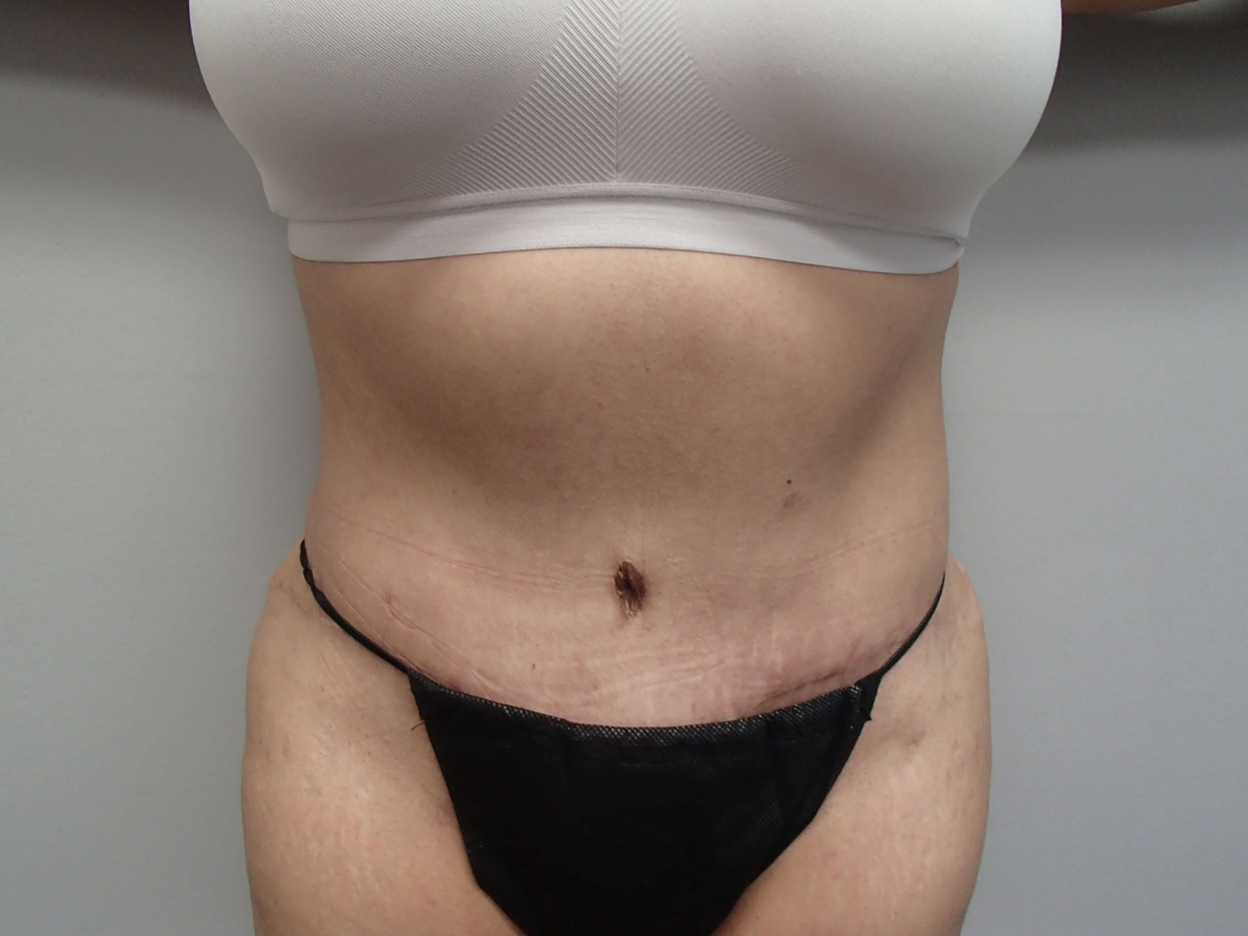 After Image