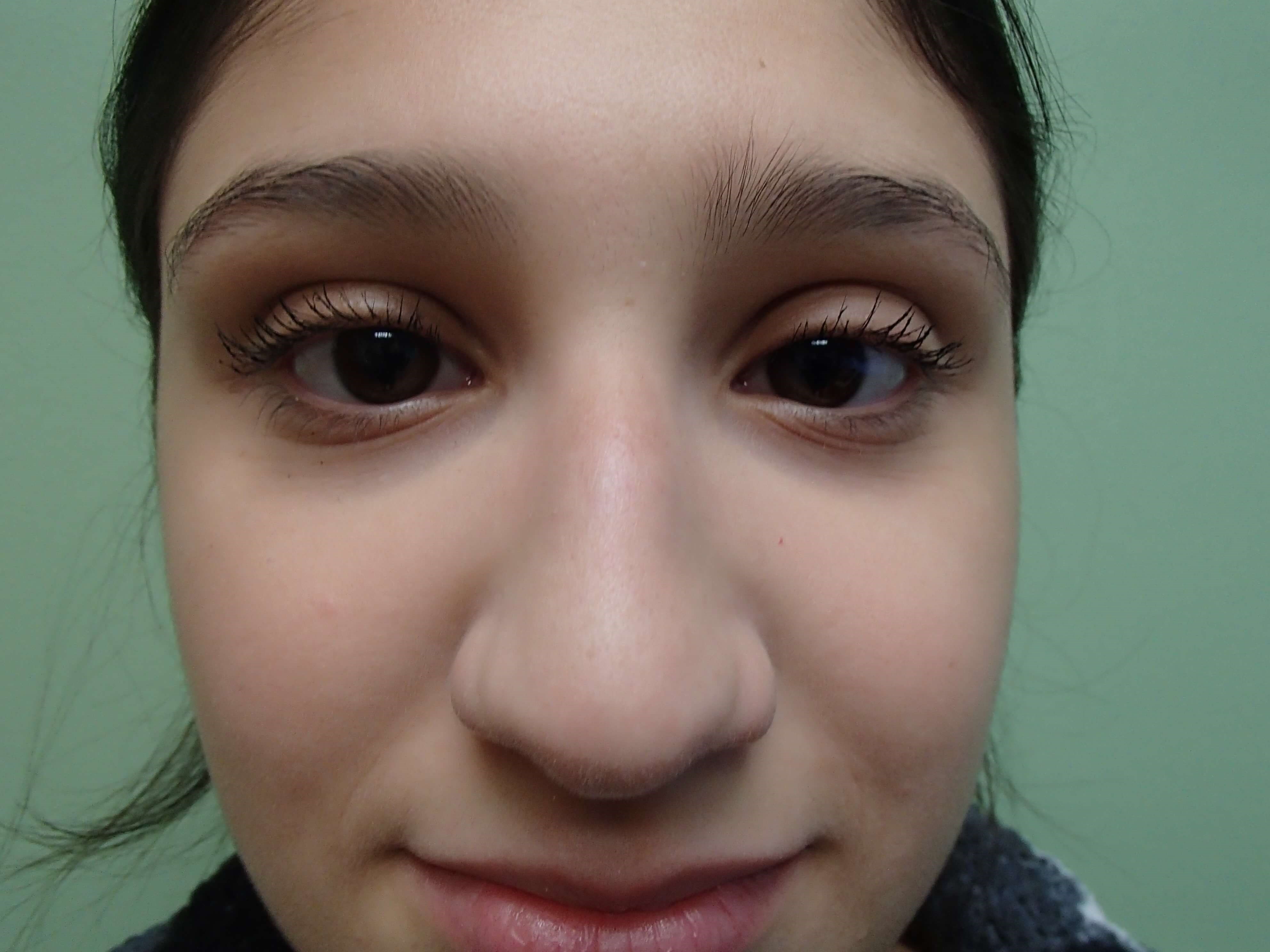 Before Image