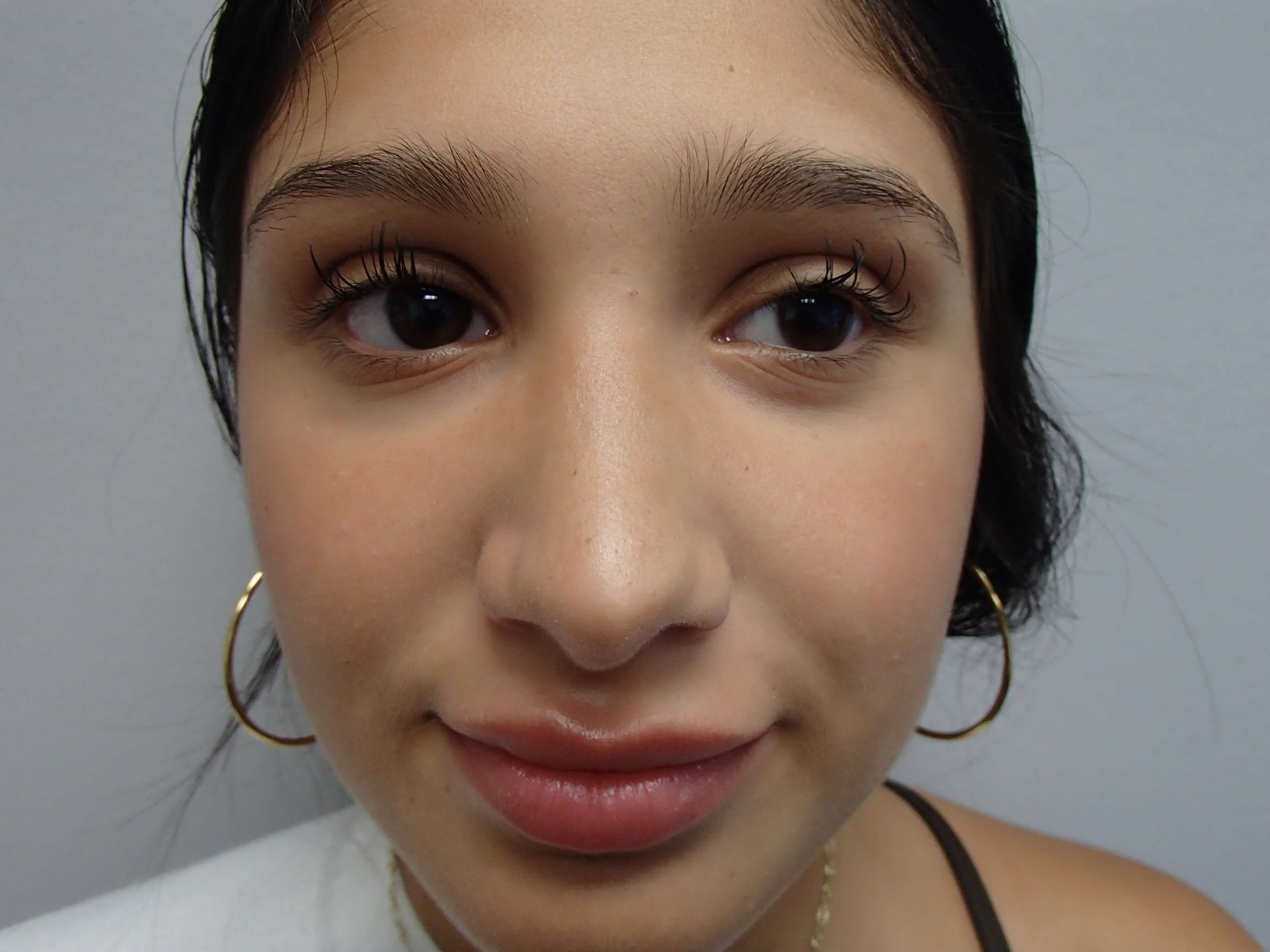 After Image