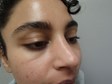 After Image
