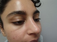 After Image