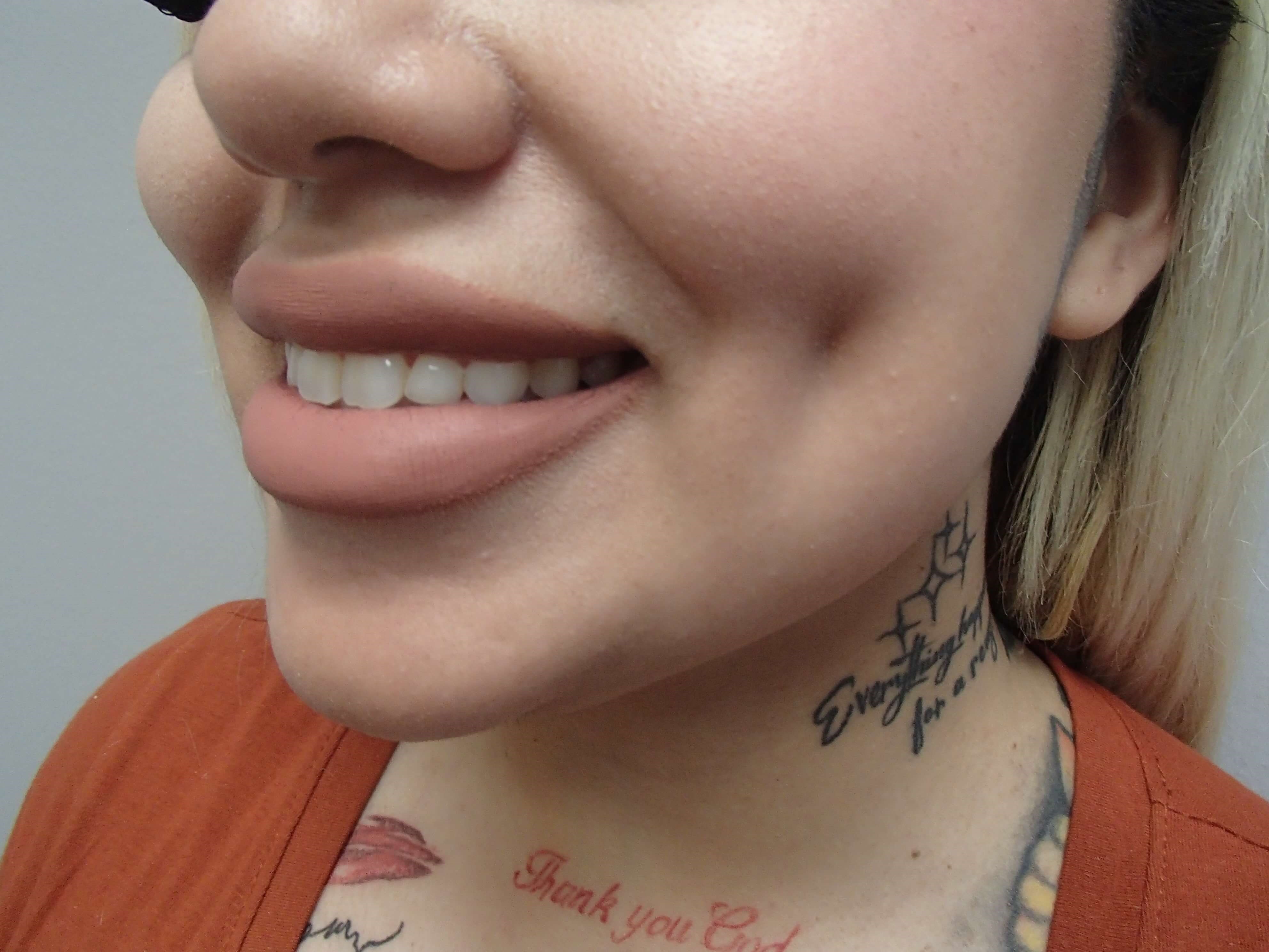 Timeless Dimples After