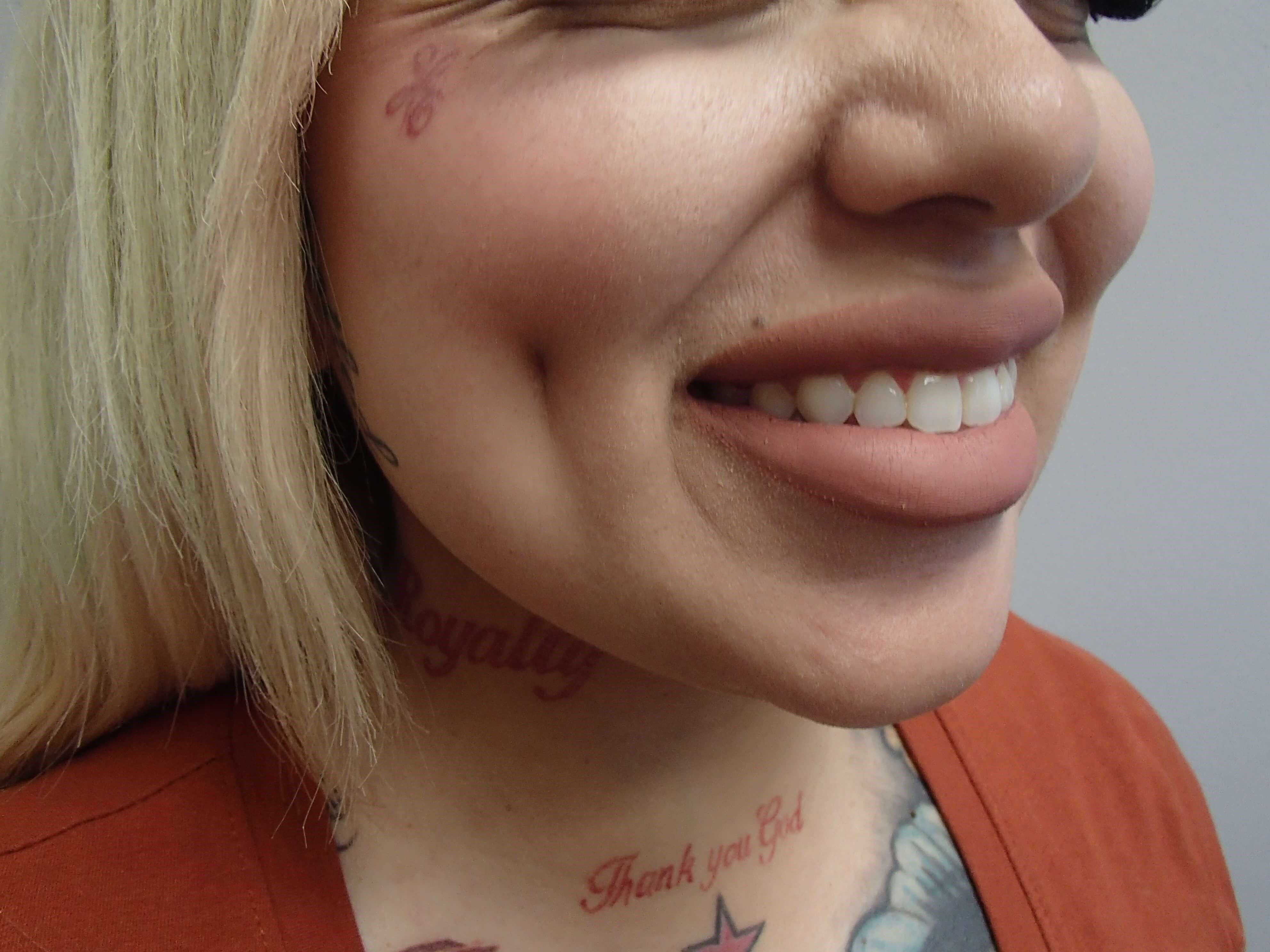 Timeless Dimples After