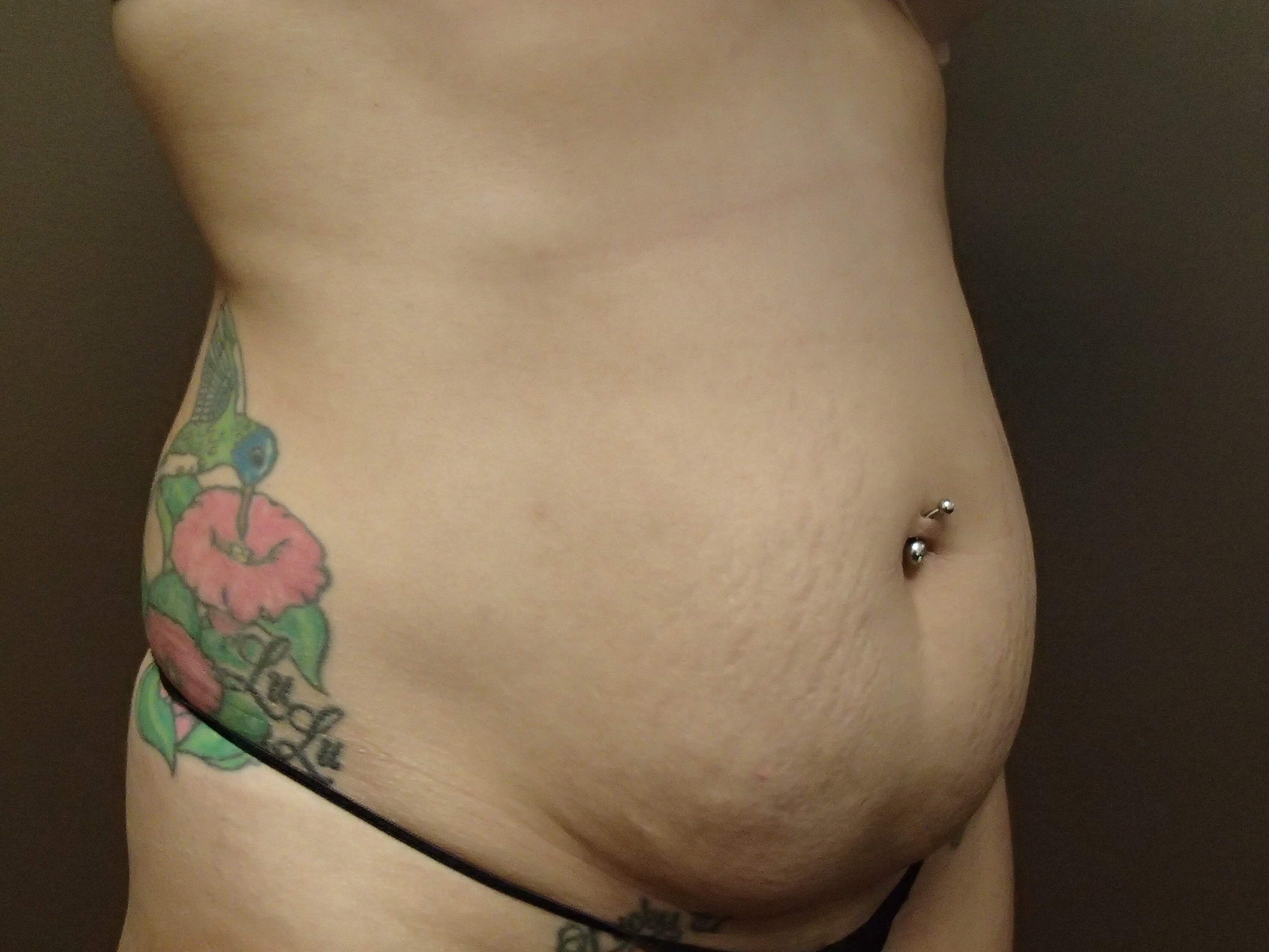 Timeless Tuck Oblique View Before
