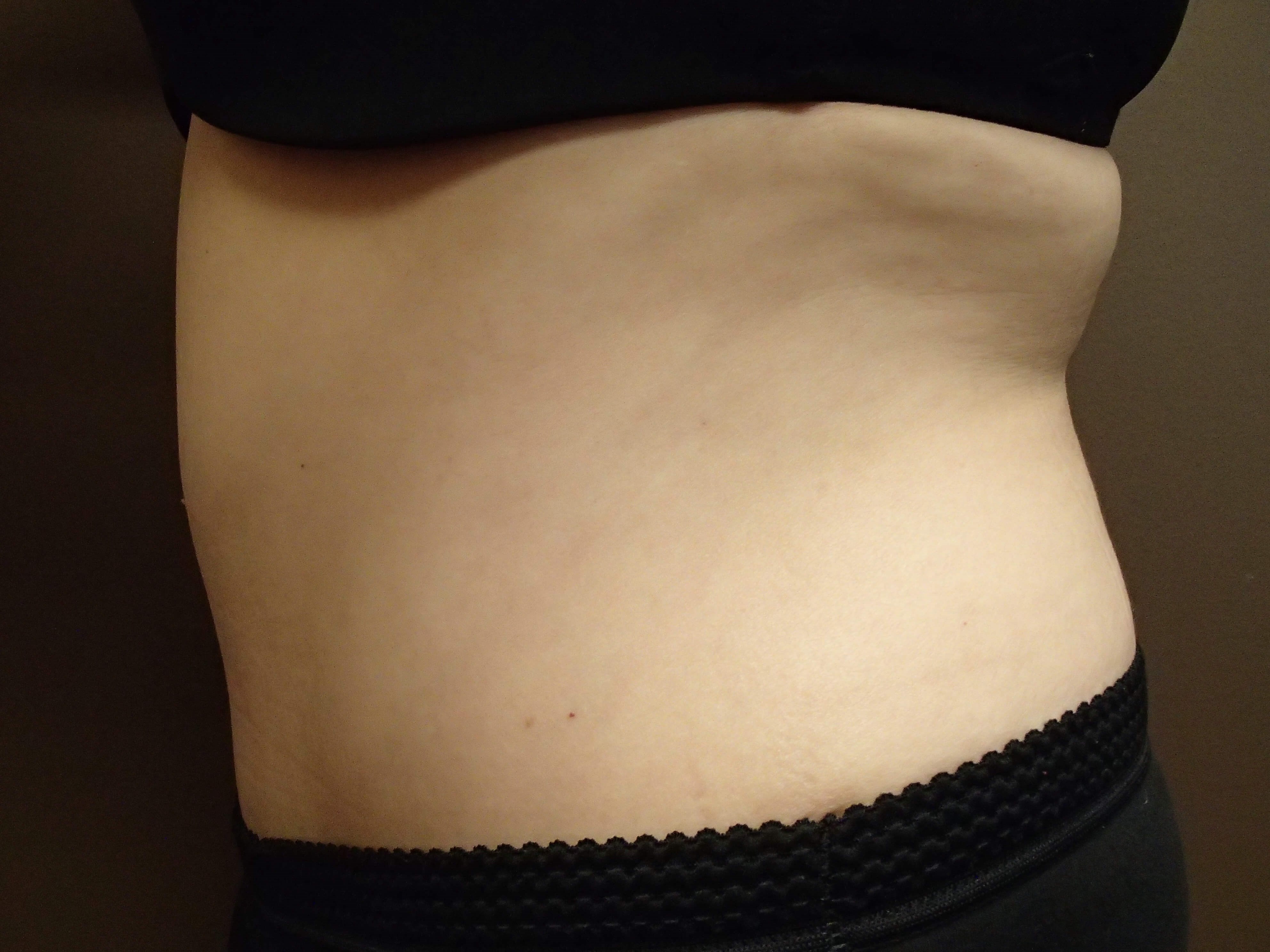 Timeless Tuck Side View After