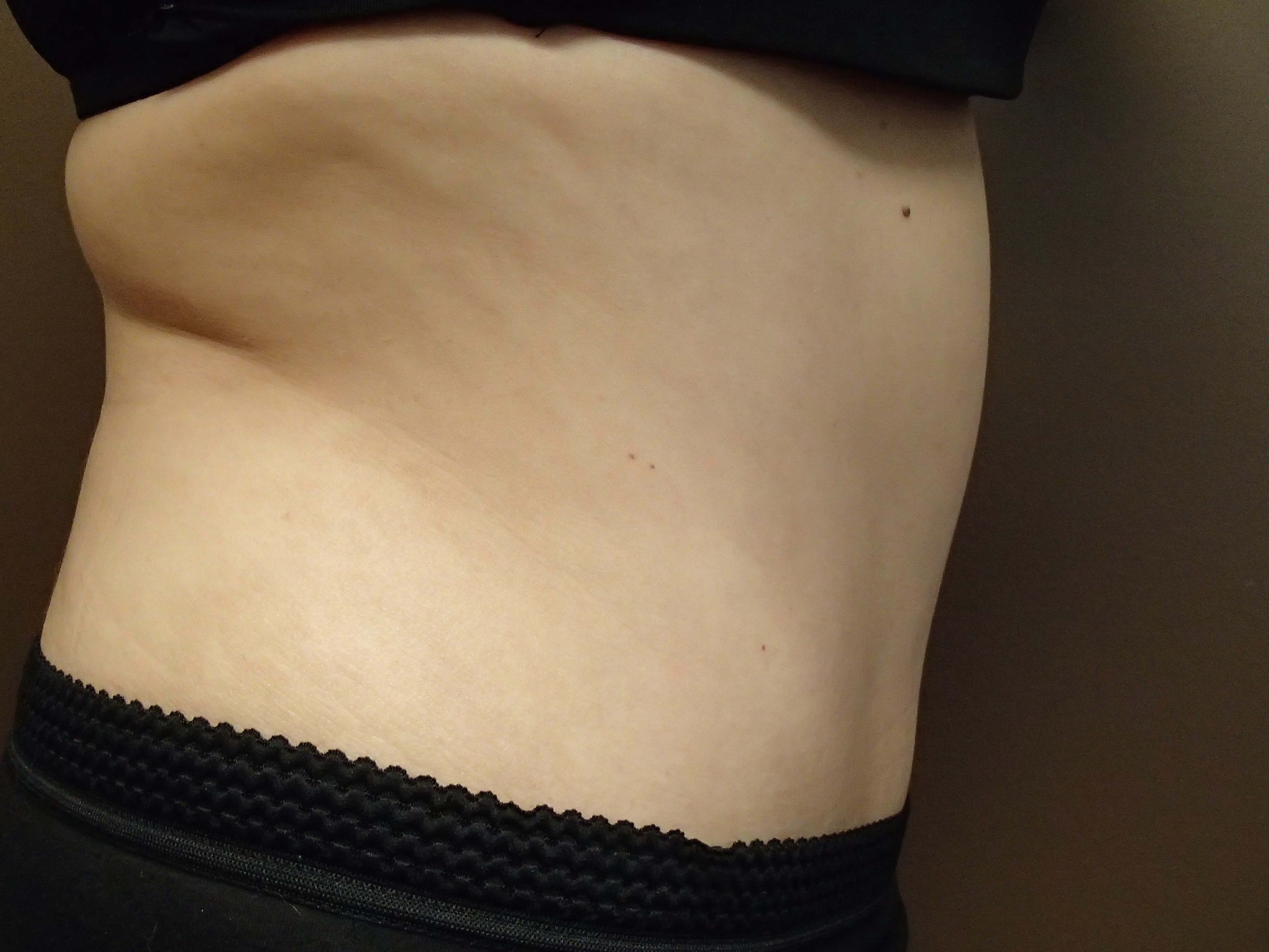 Timeless Tuck Side View After