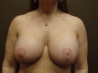 After Image