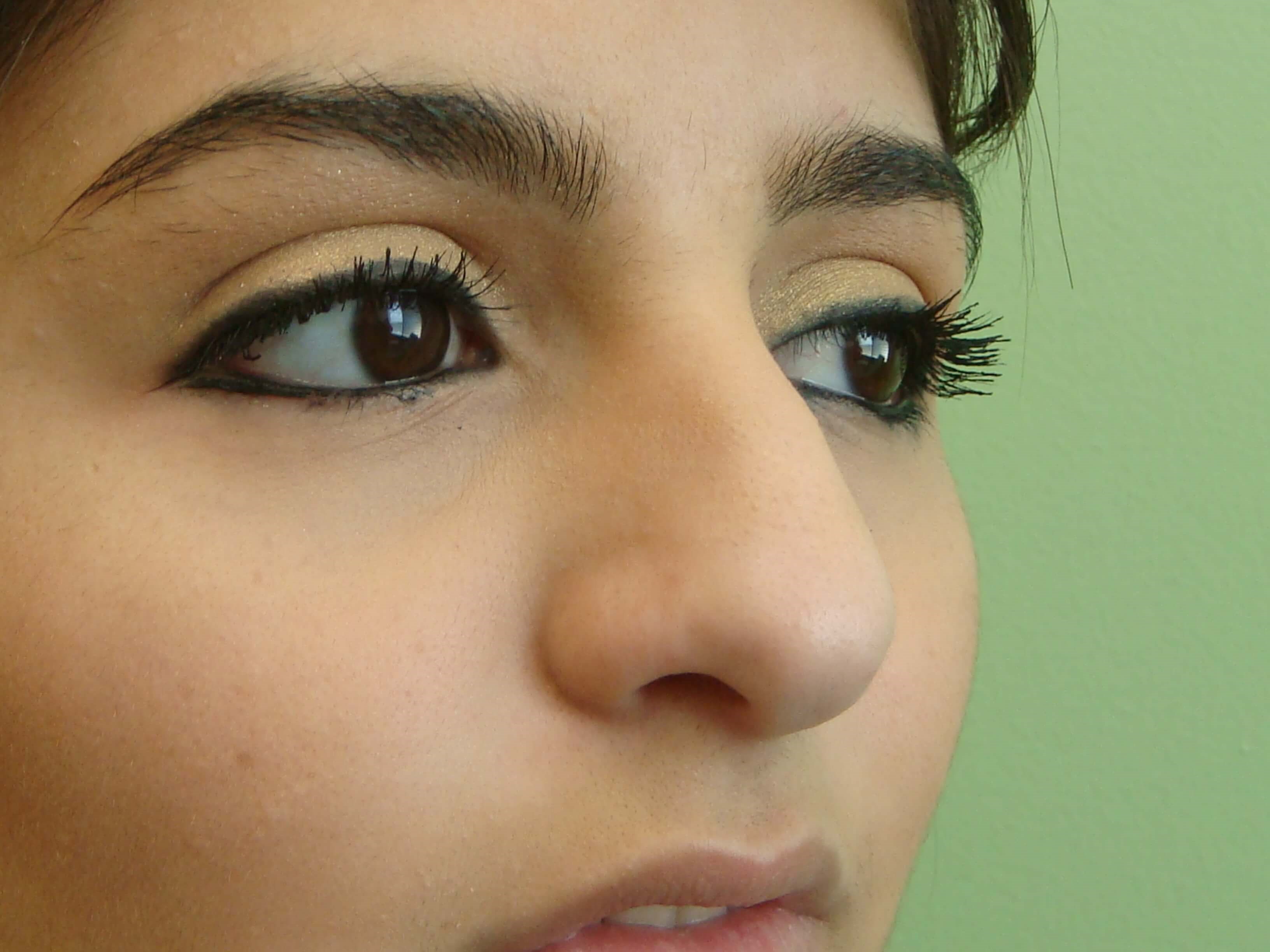 Rhinoplasty (nose job) Before