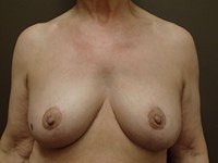 After Image