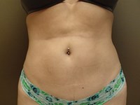 After Image