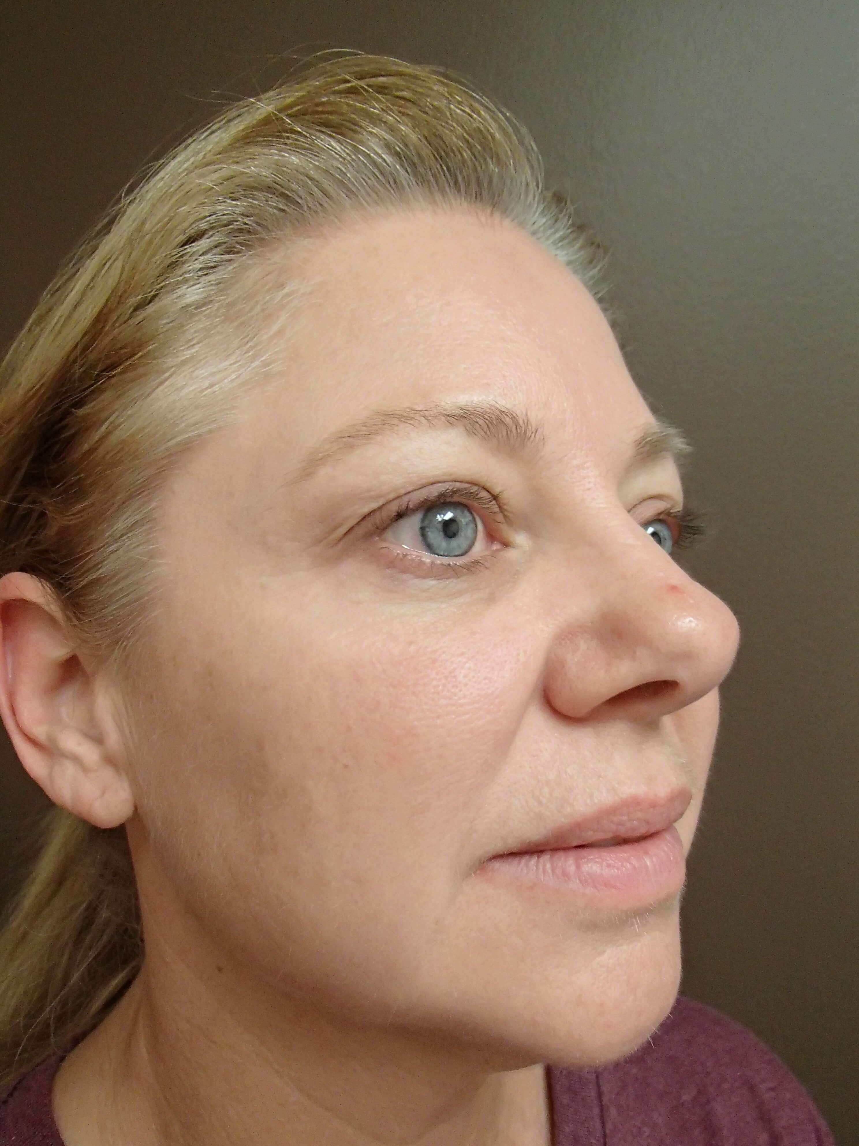 Before Image