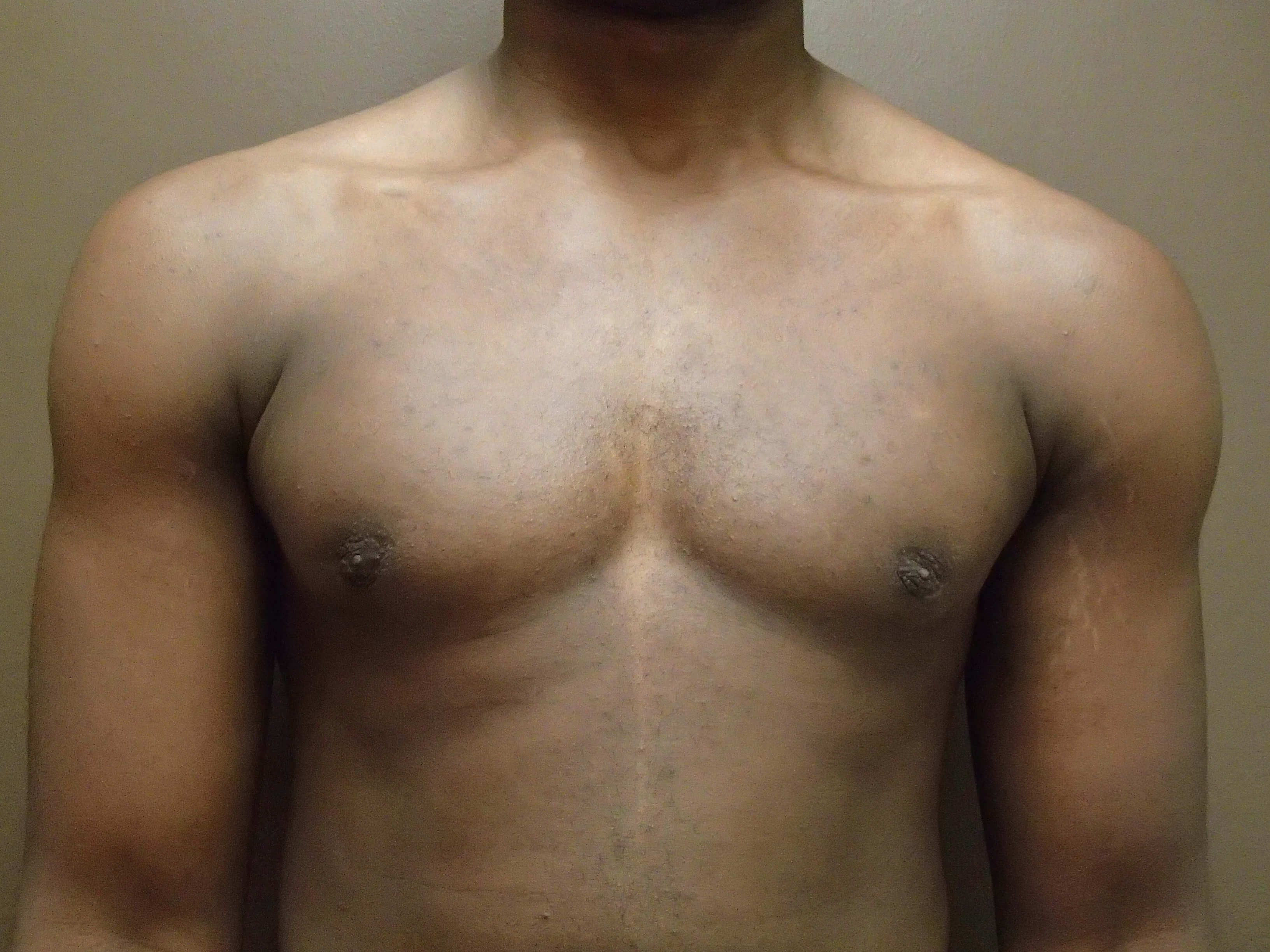 After Image