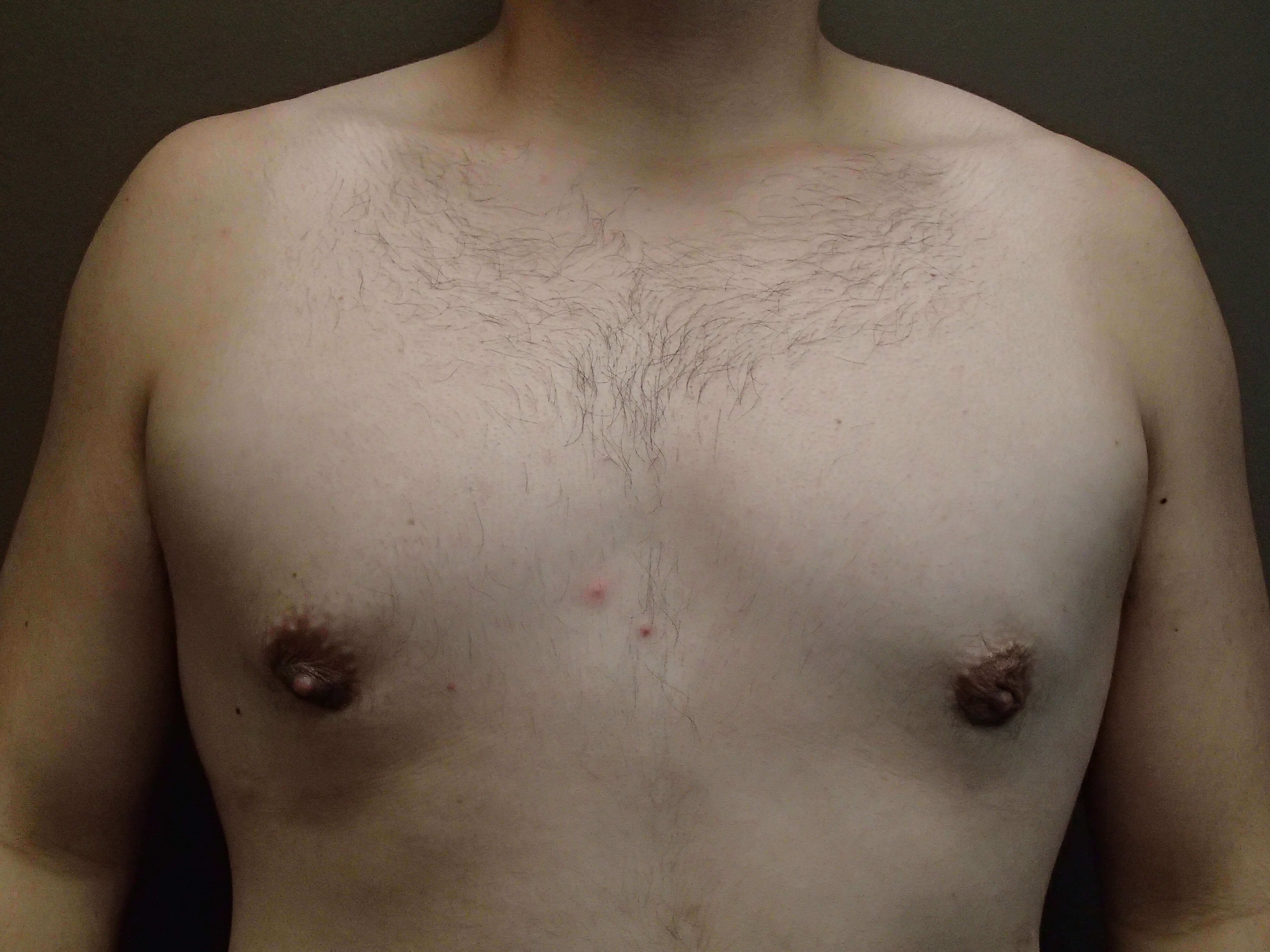 After Image