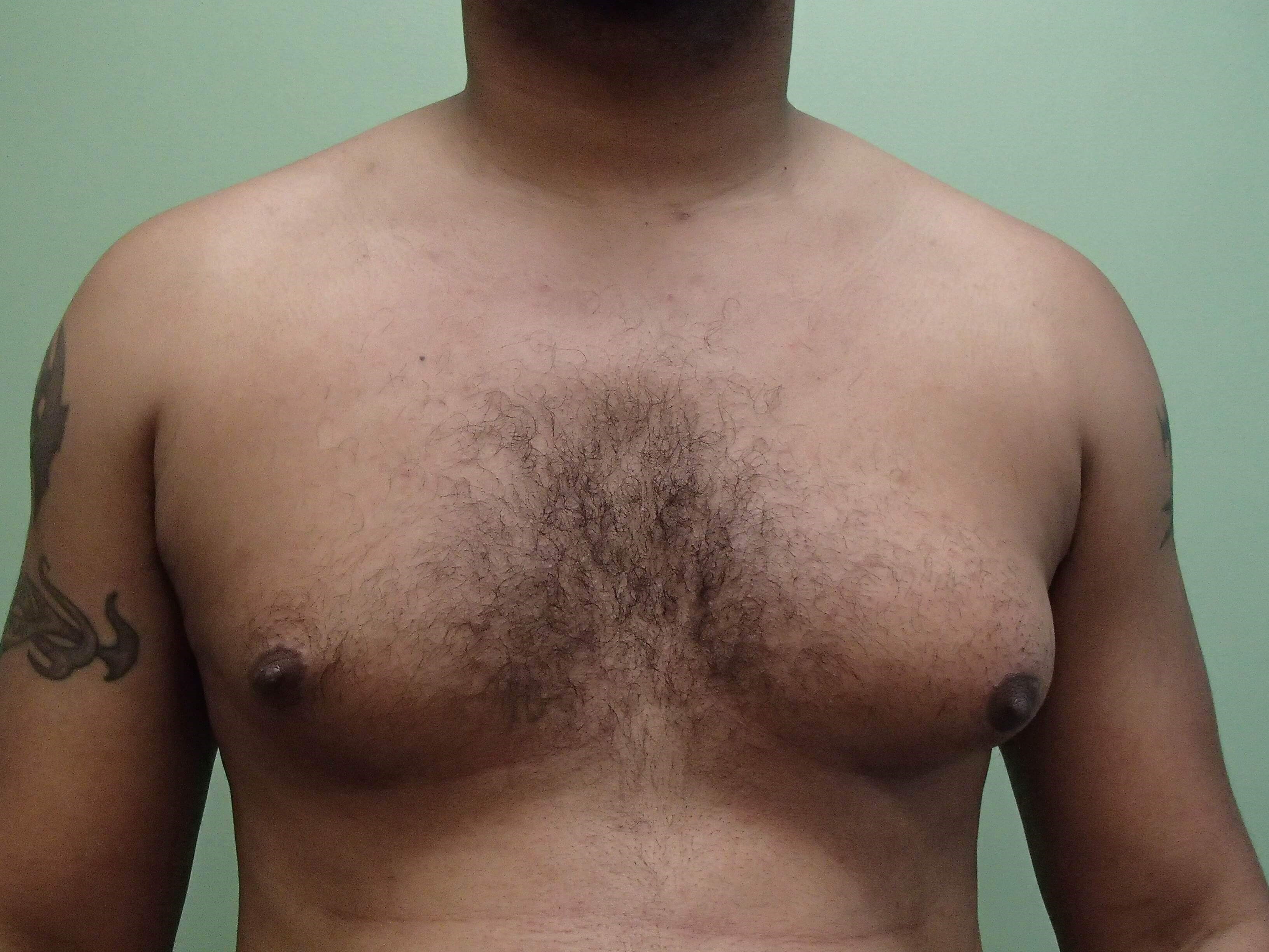 Before Image