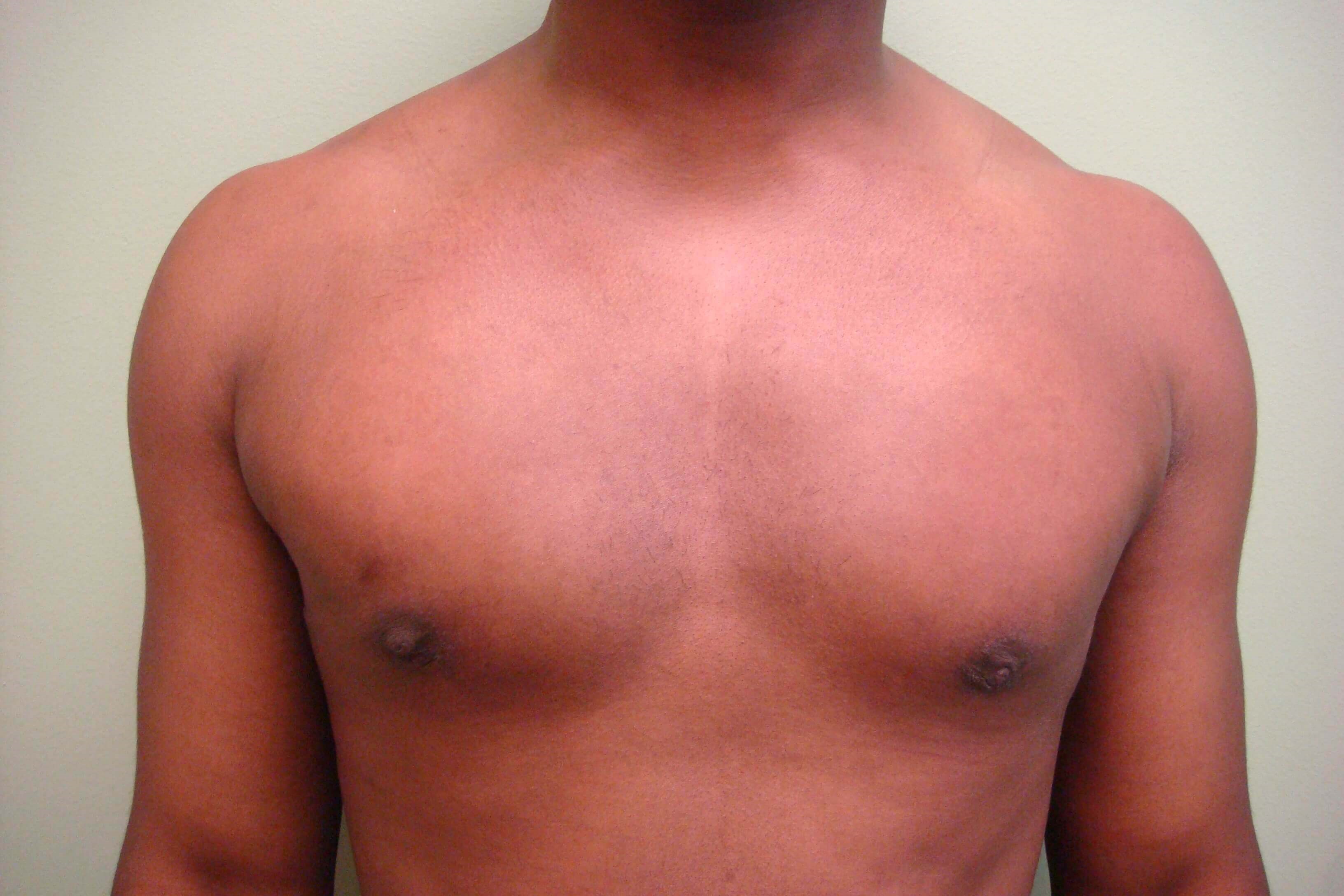 After Image