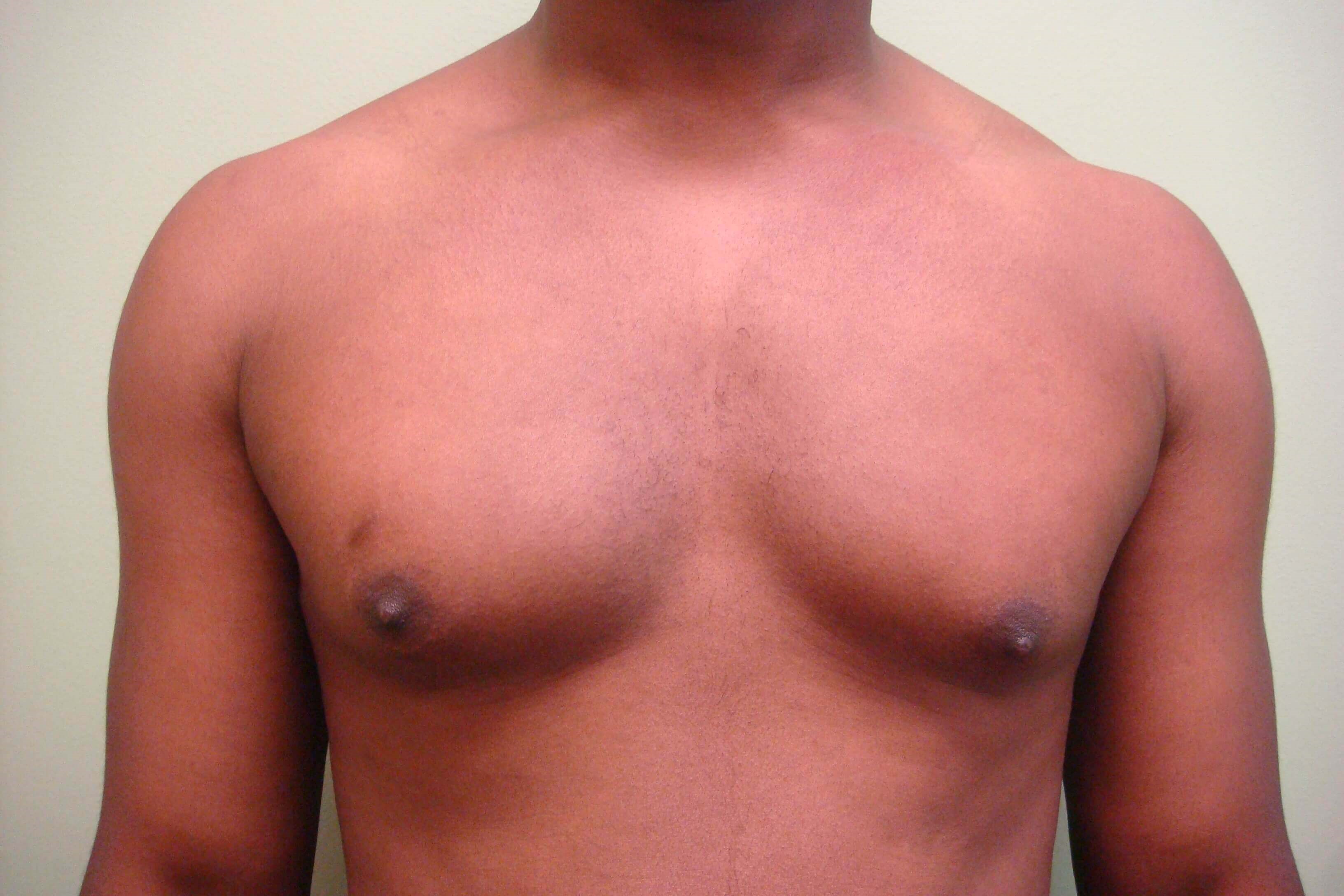 Before Image