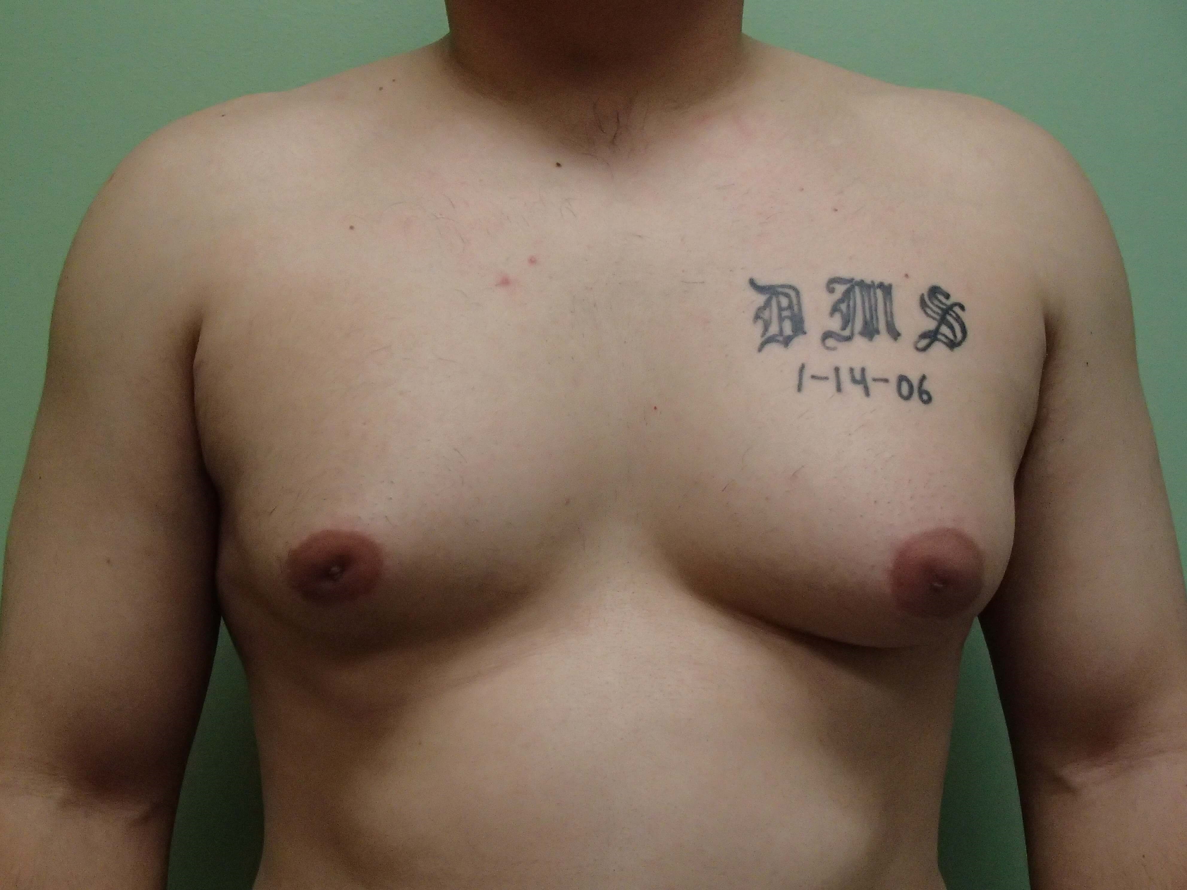 Before Image