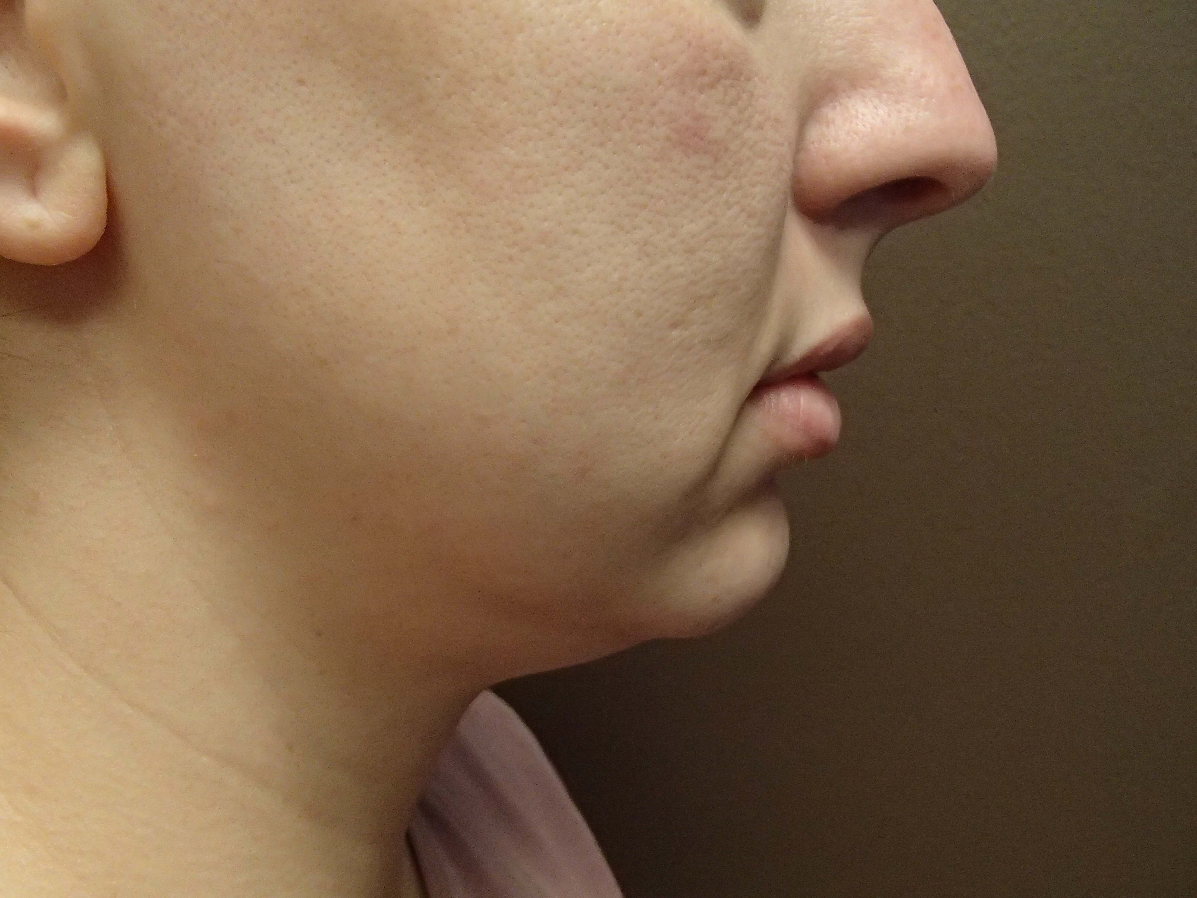 Before Image