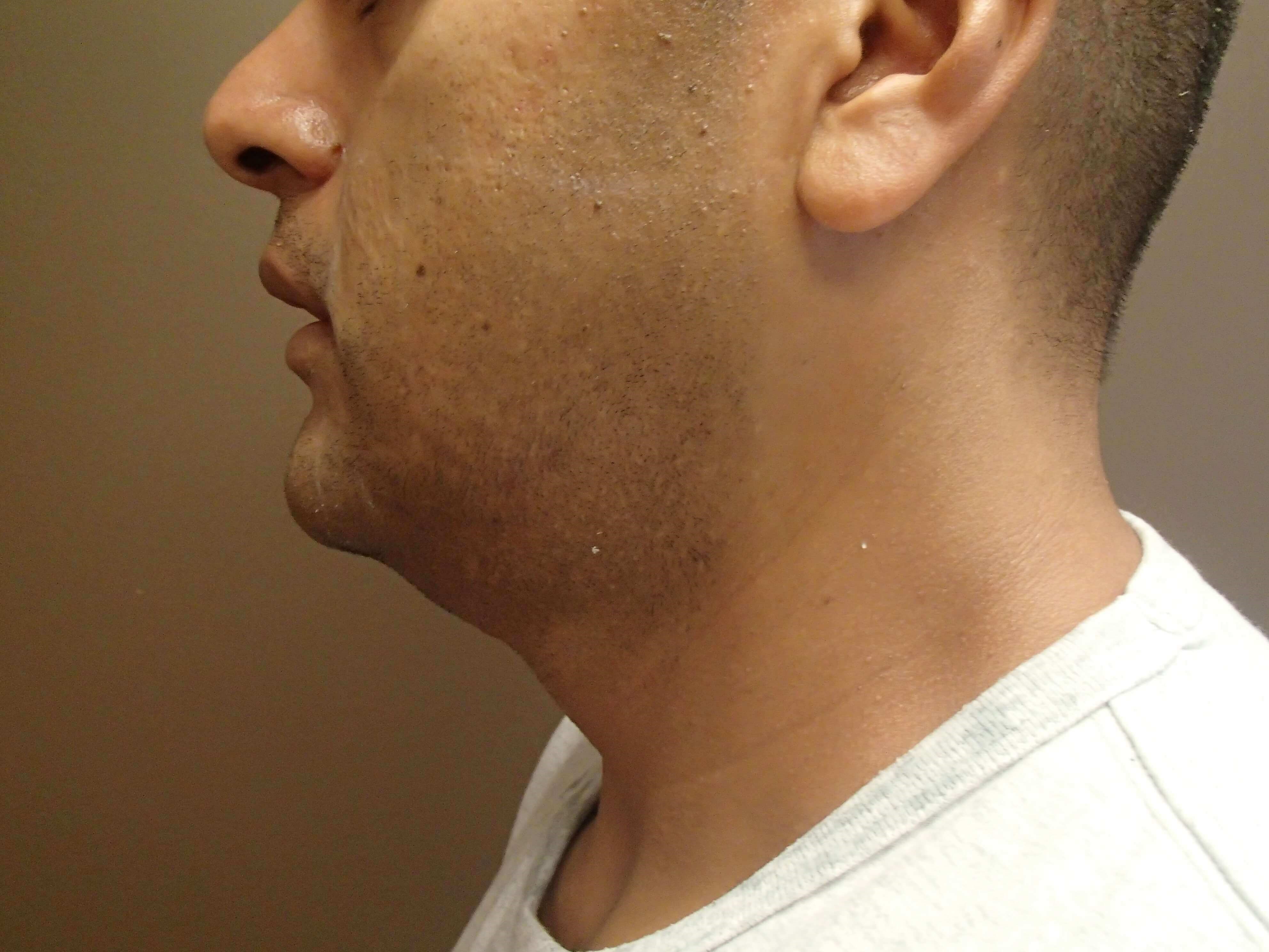 Before Image