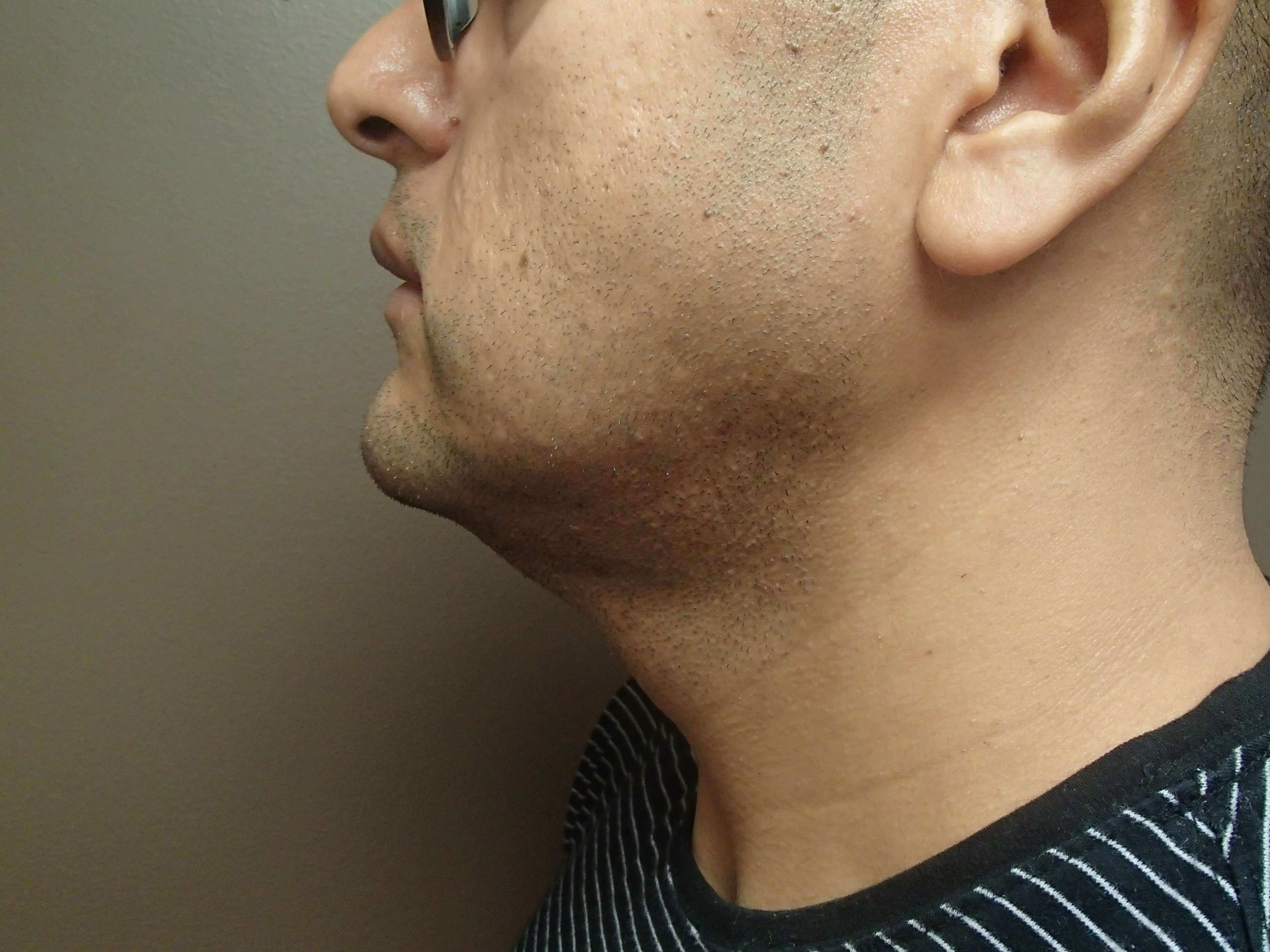 After Image
