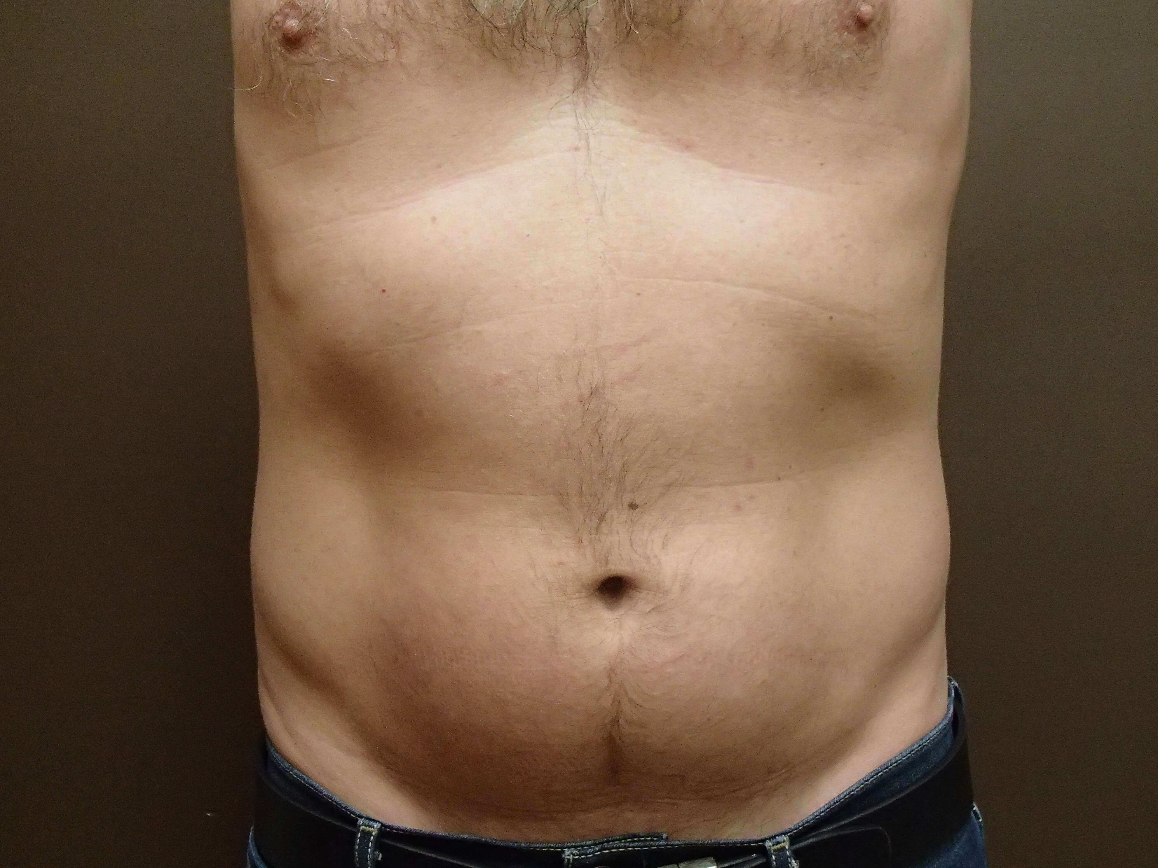 After Image
